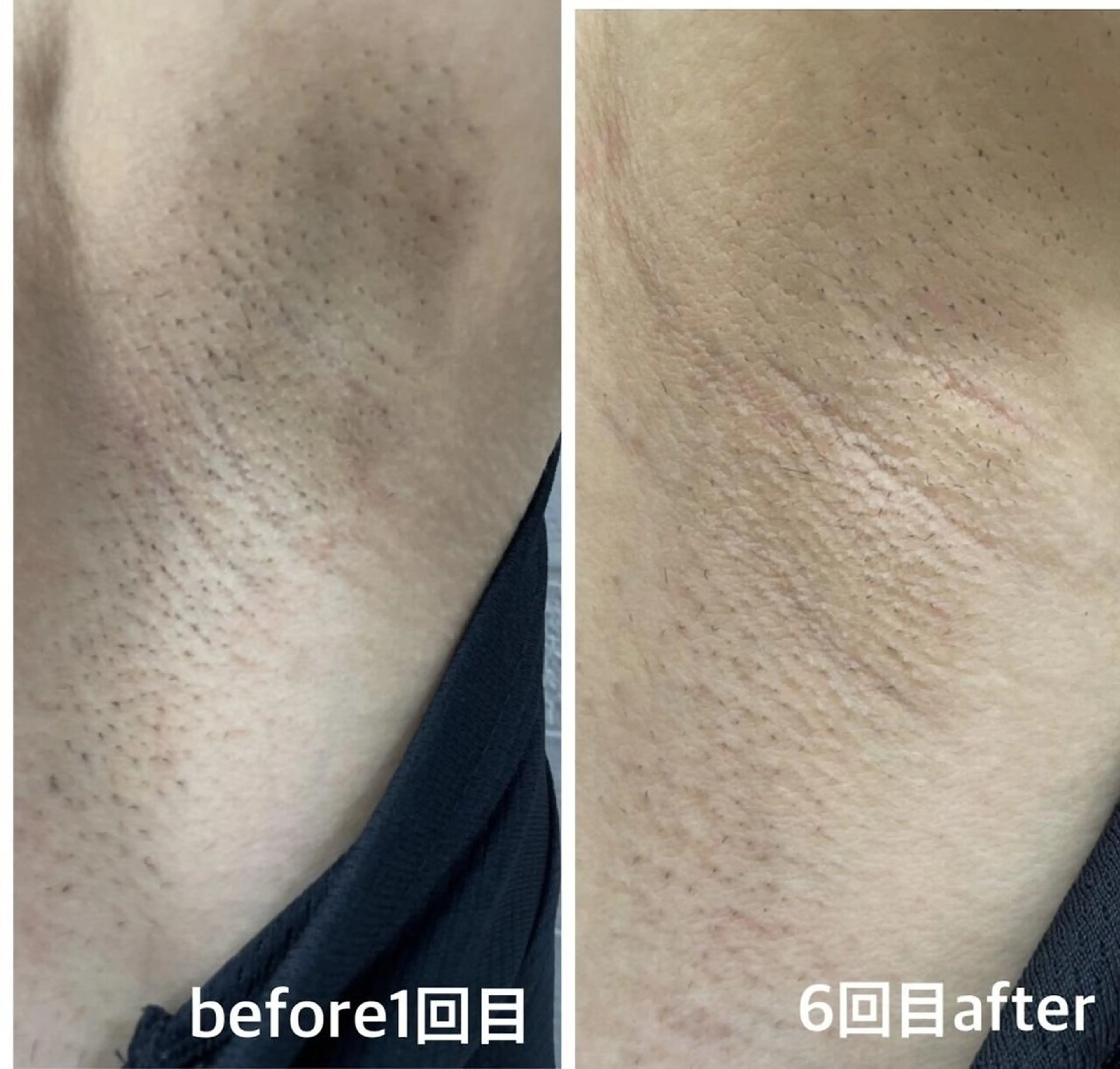 SELFMADE 石巻店のエステ・リラクイメージ