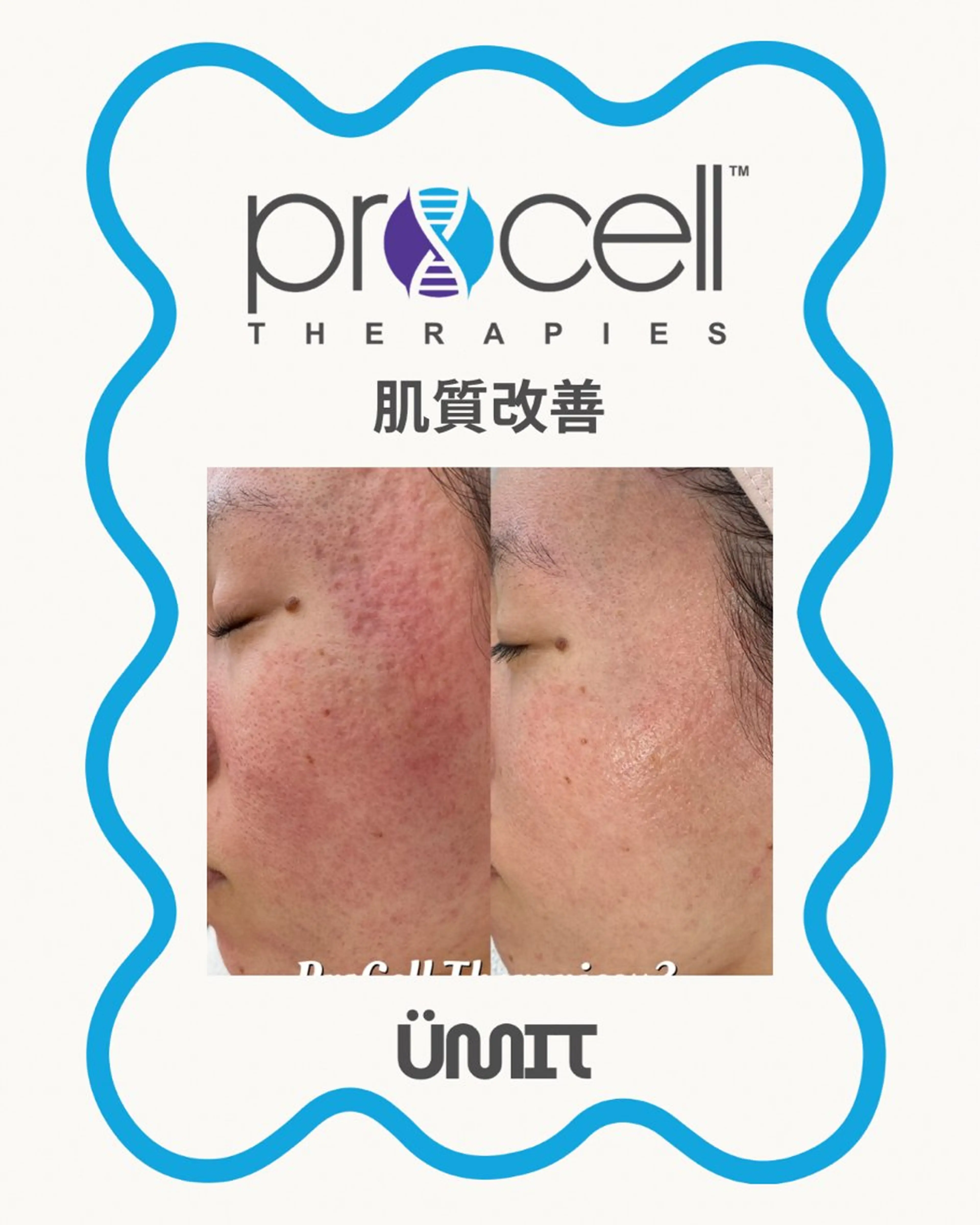 エステ Ümit（ユミト） プロセルセラピーズのヘアスタイル