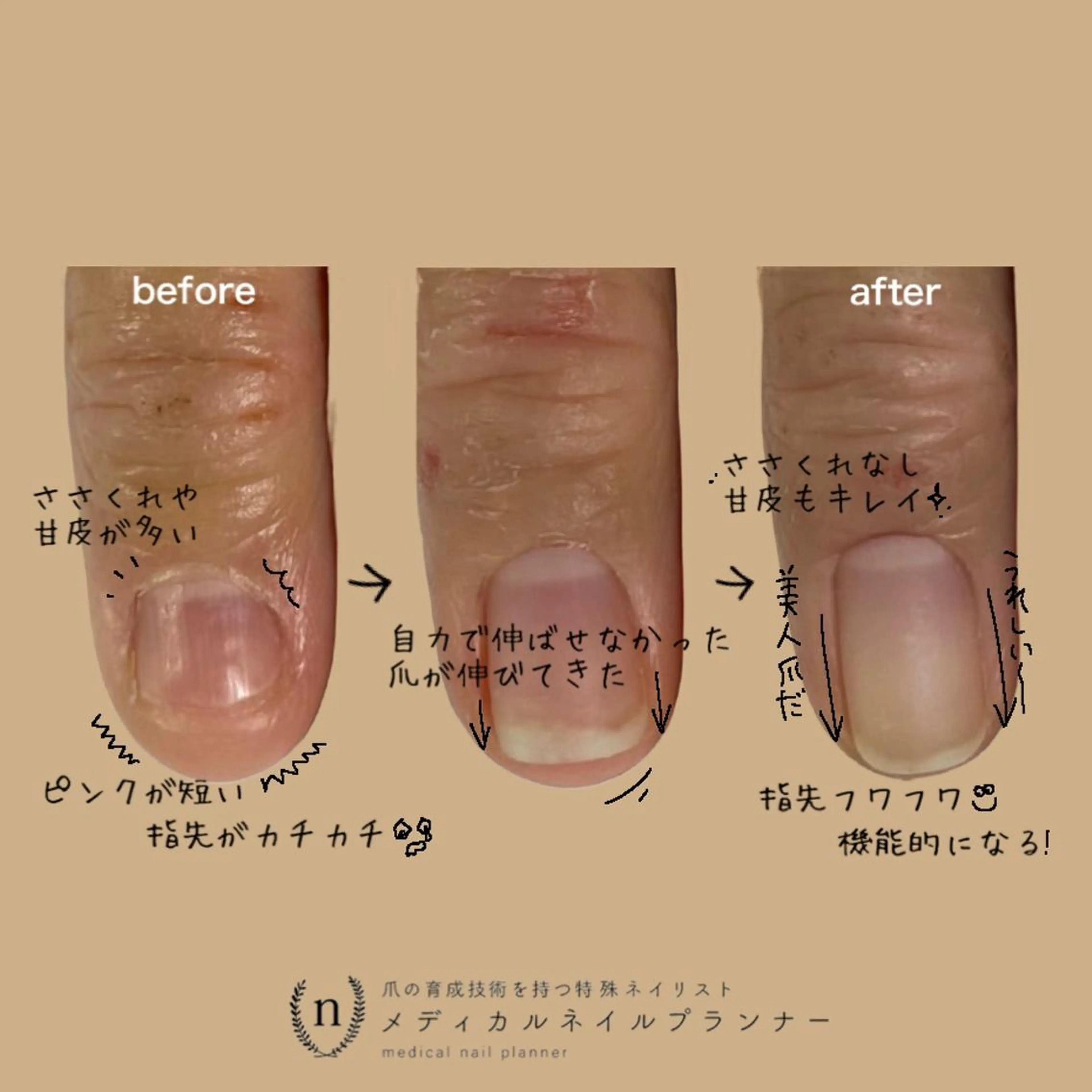 ネイル ハンドネイル ハンドケア tsuki elfのエステ・リラクイメージ