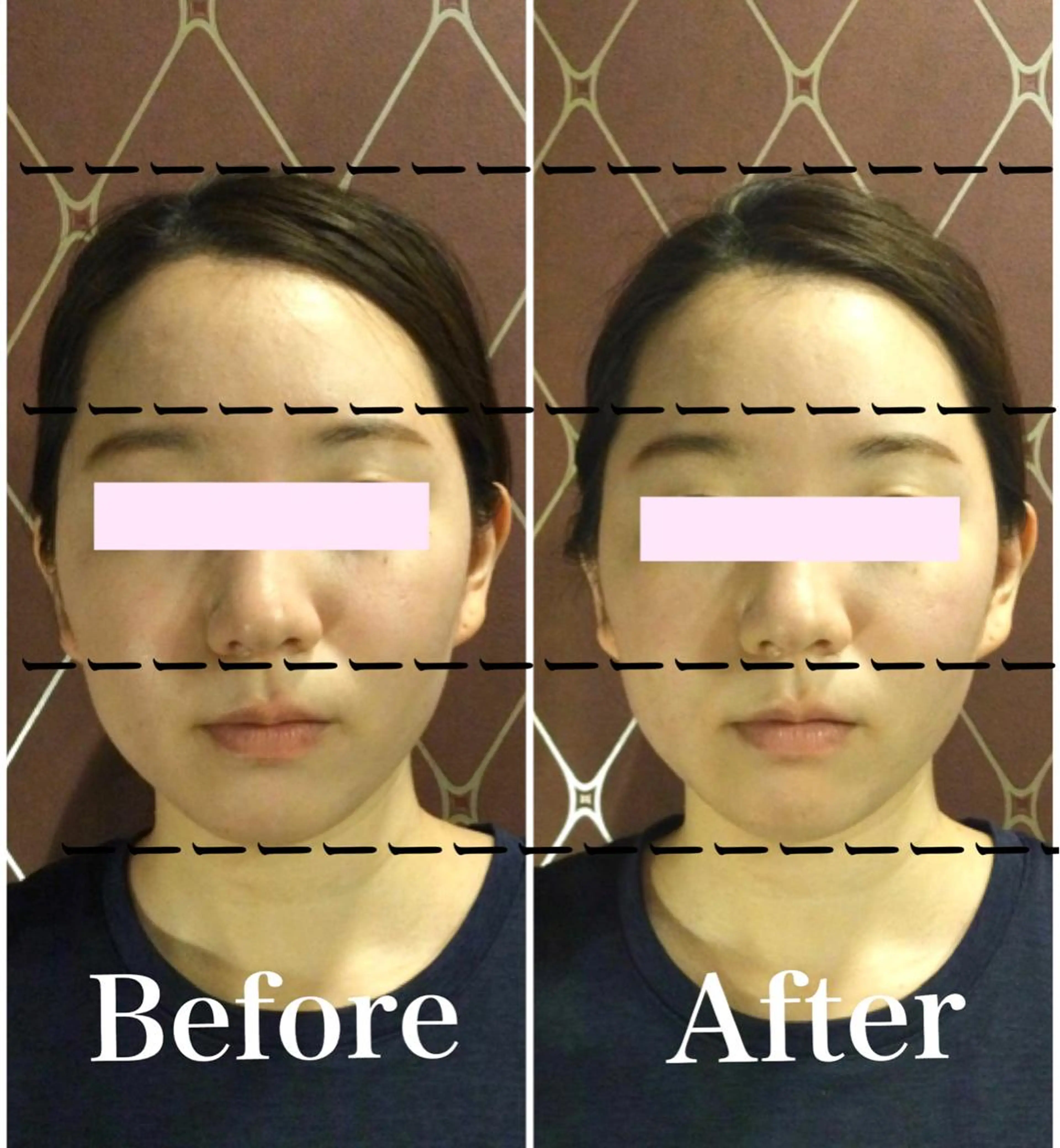 DEA  LUCE所属・痩身&小顔エステ DEA   LUCEのエステ・リラクイメージ