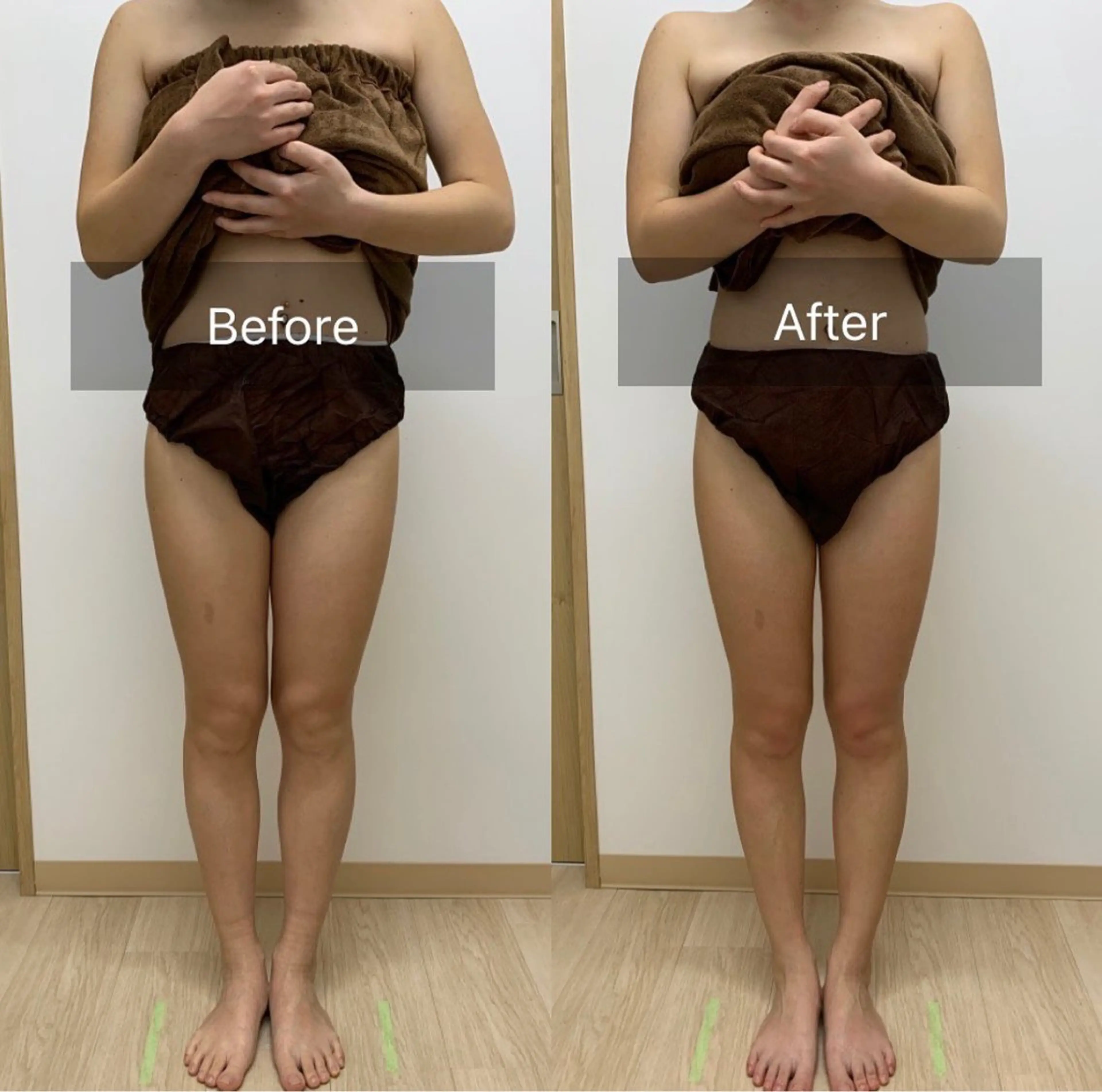 痩身エステ〔半身コース〕の写真