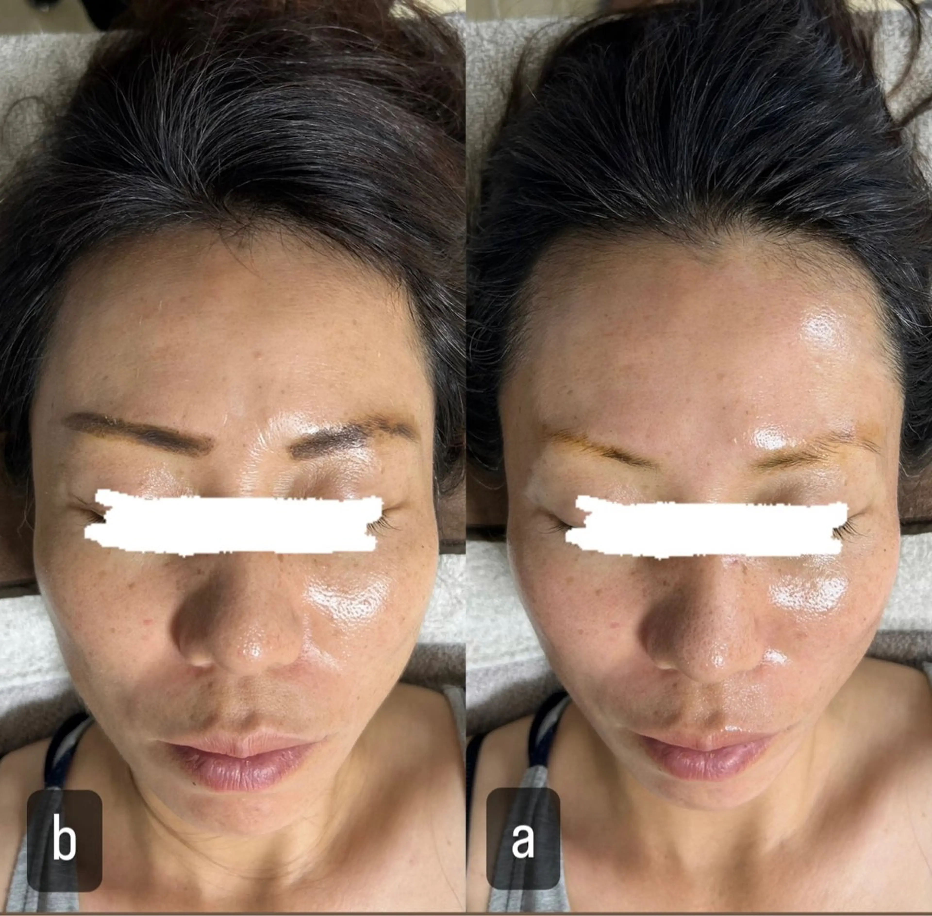 217whitening  room所属・217 ホワイトニングルームのエステ・リラクイメージ