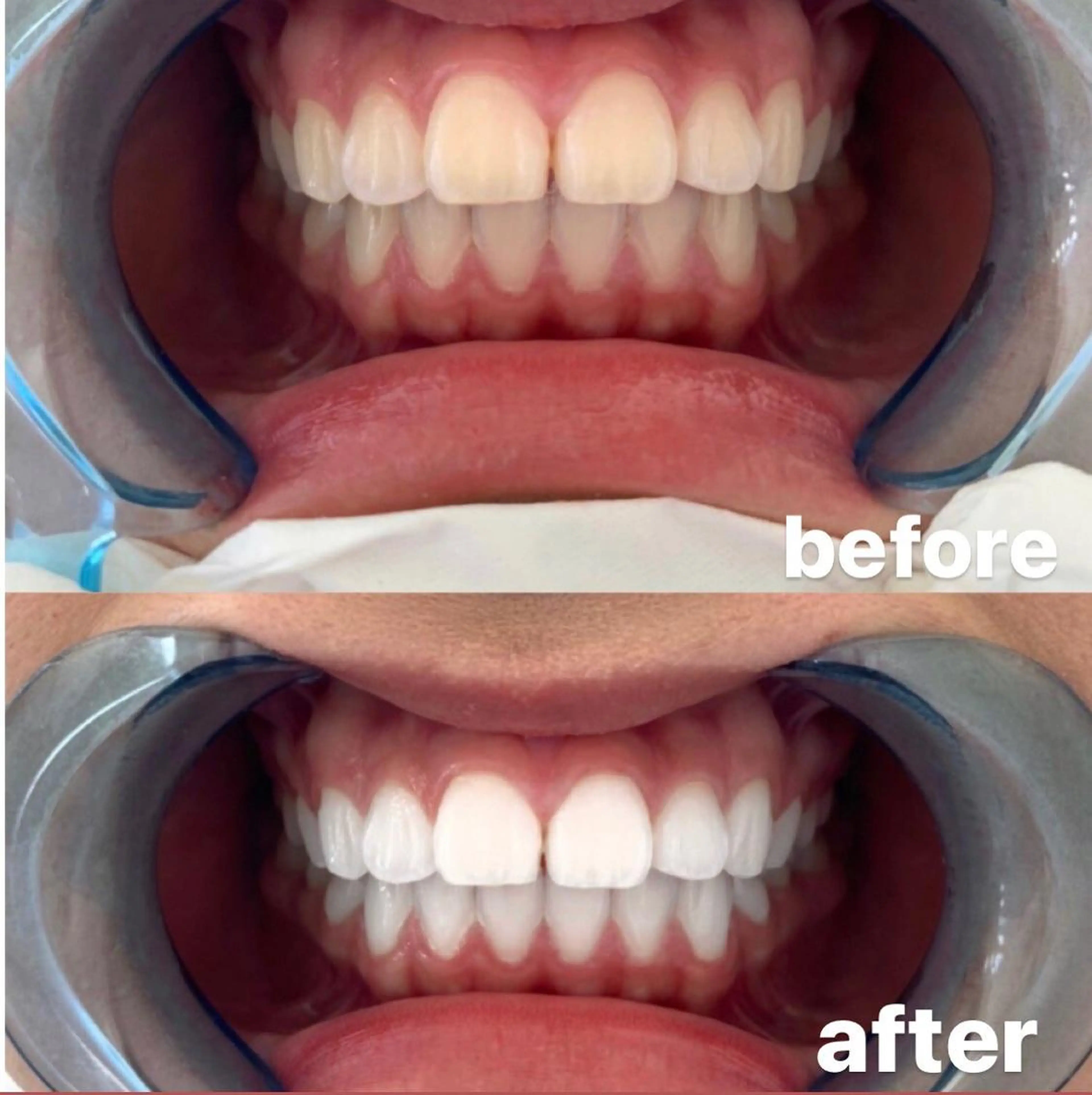 その他 ライトビューティー 恵比寿店のその他イメージ