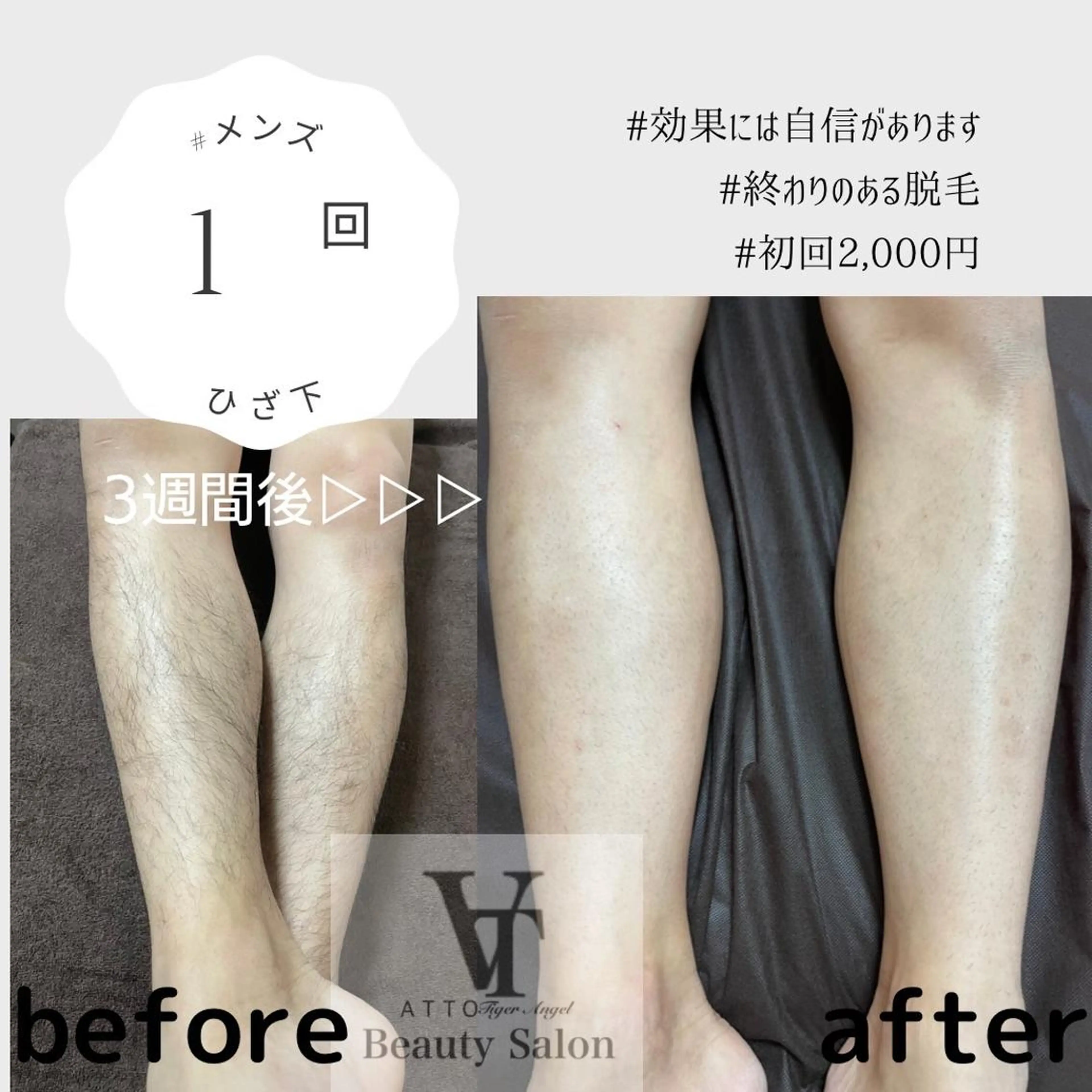 メンズ 脱毛 ATTO SHIORIのエステ・リラクイメージ