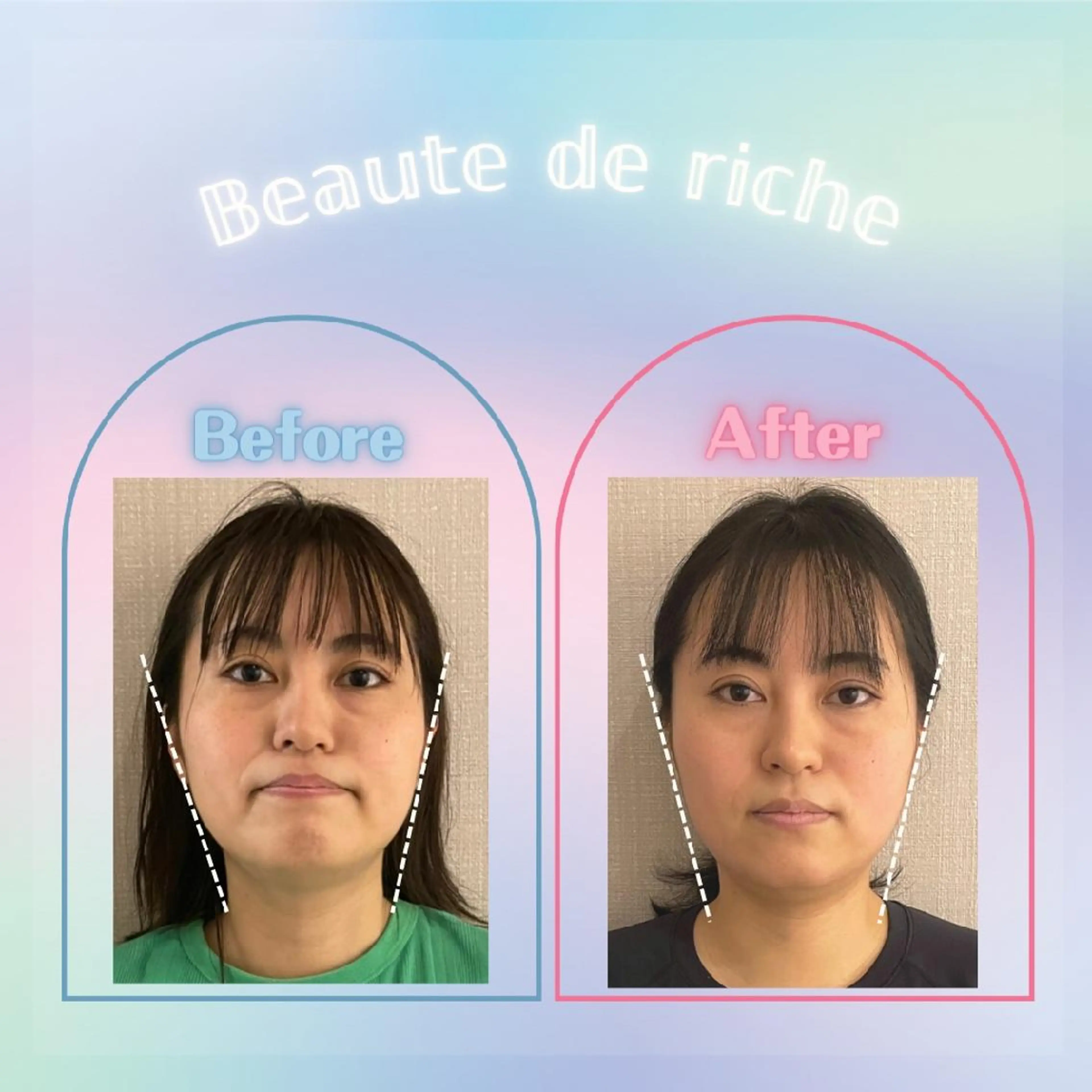 エステ リラク 小顔・肌悩み専門店 ボーテドリッシュのエステ・リラクイメージ