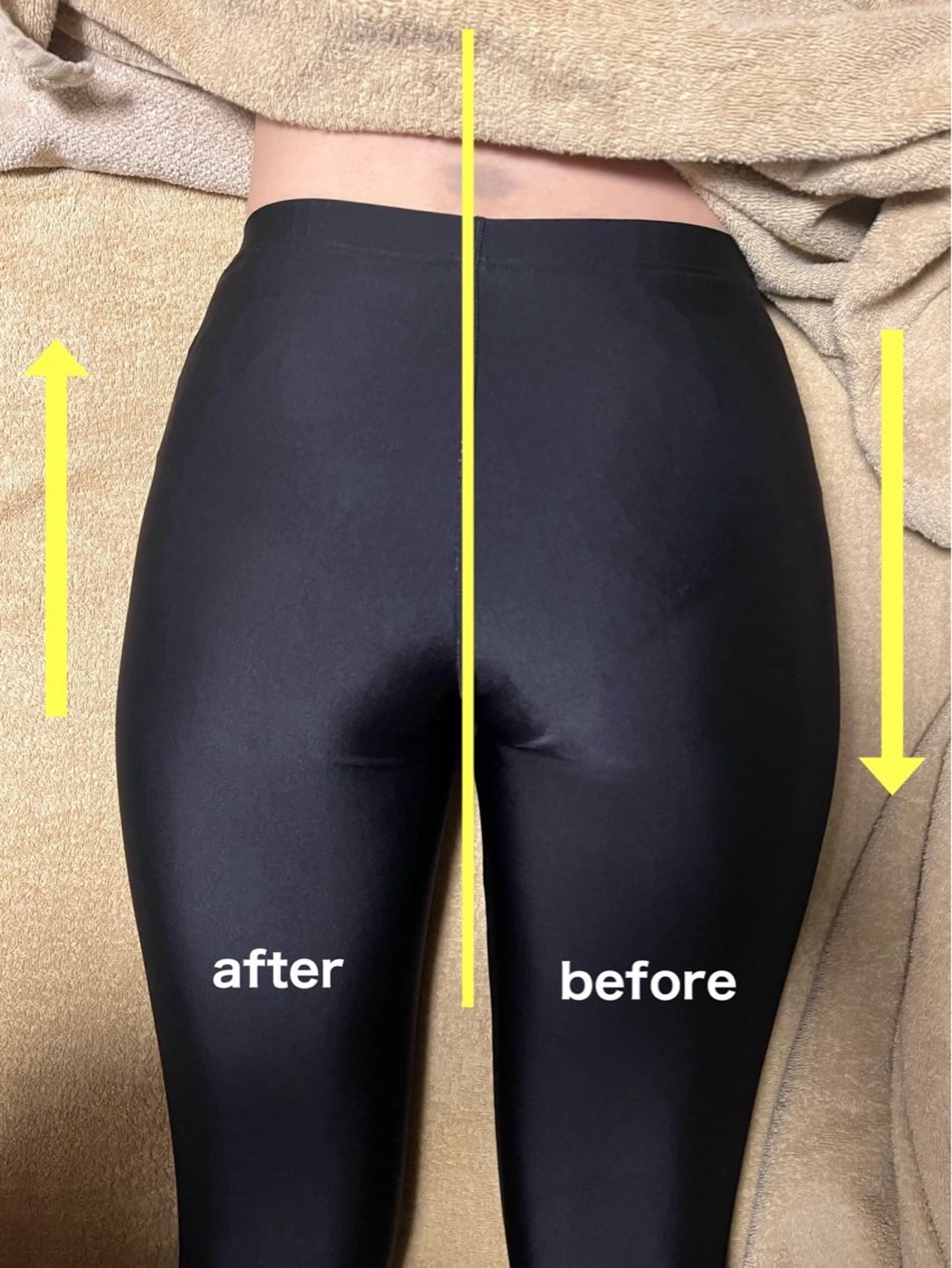 【産後骨盤調整】痩せやすい体質へ！歪み改善で小尻！姿勢改善にも◎の写真