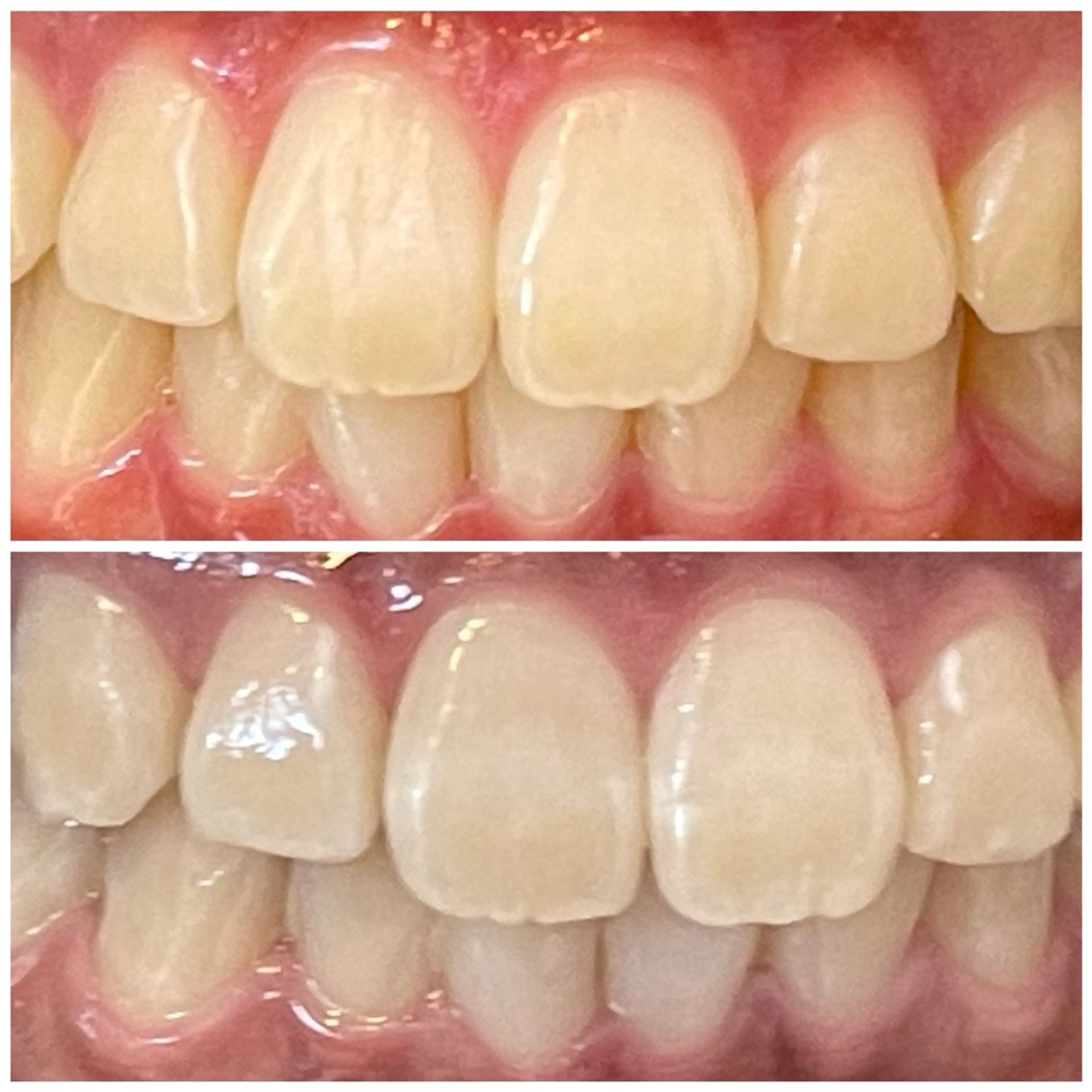 ダイヤモンドホワイトニング渋谷所属・DIAMOND BEAUYのその他イメージ