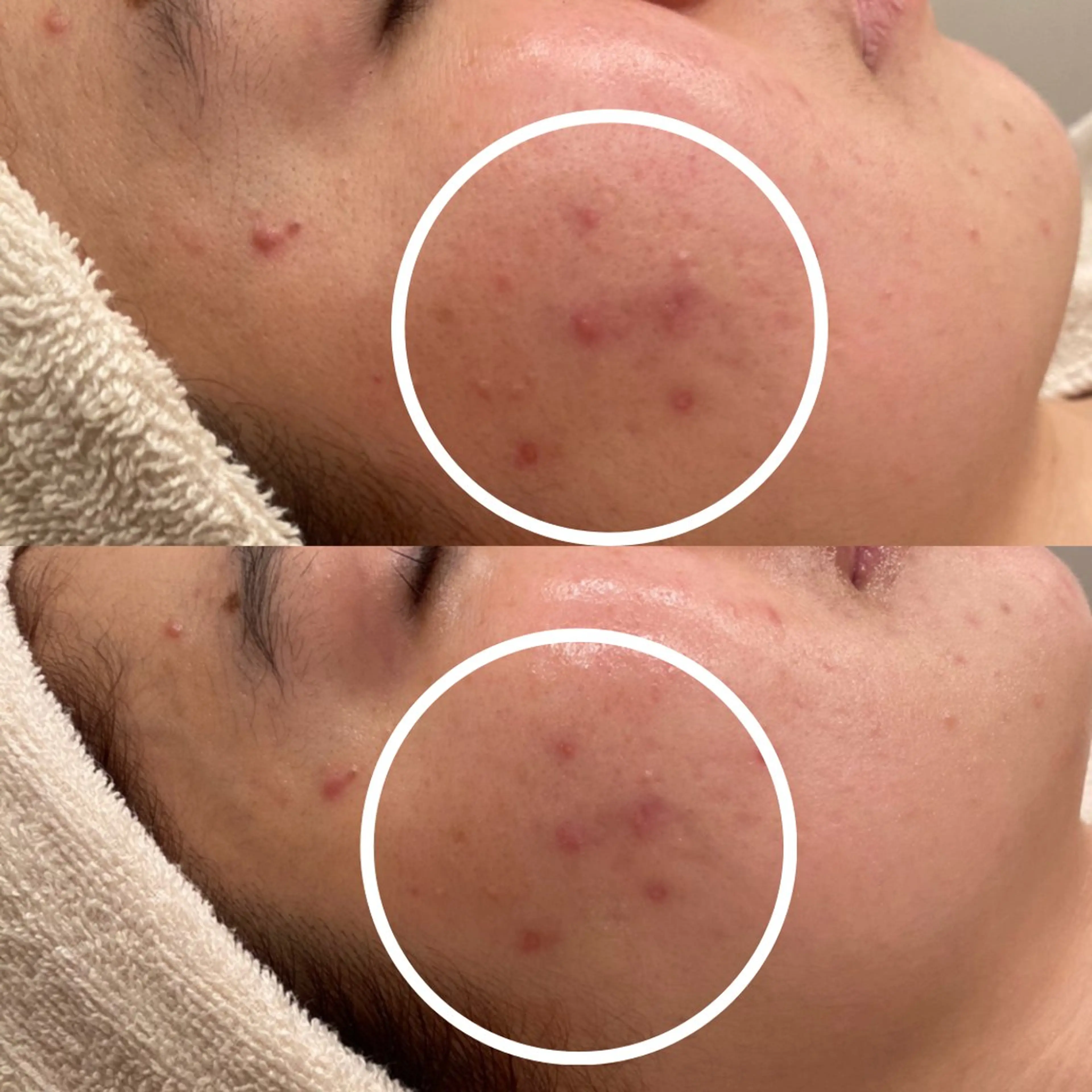 エステ リラク 田中For..天王寺 肌質改善/よもぎ蒸しのエステ・リラクイメージ