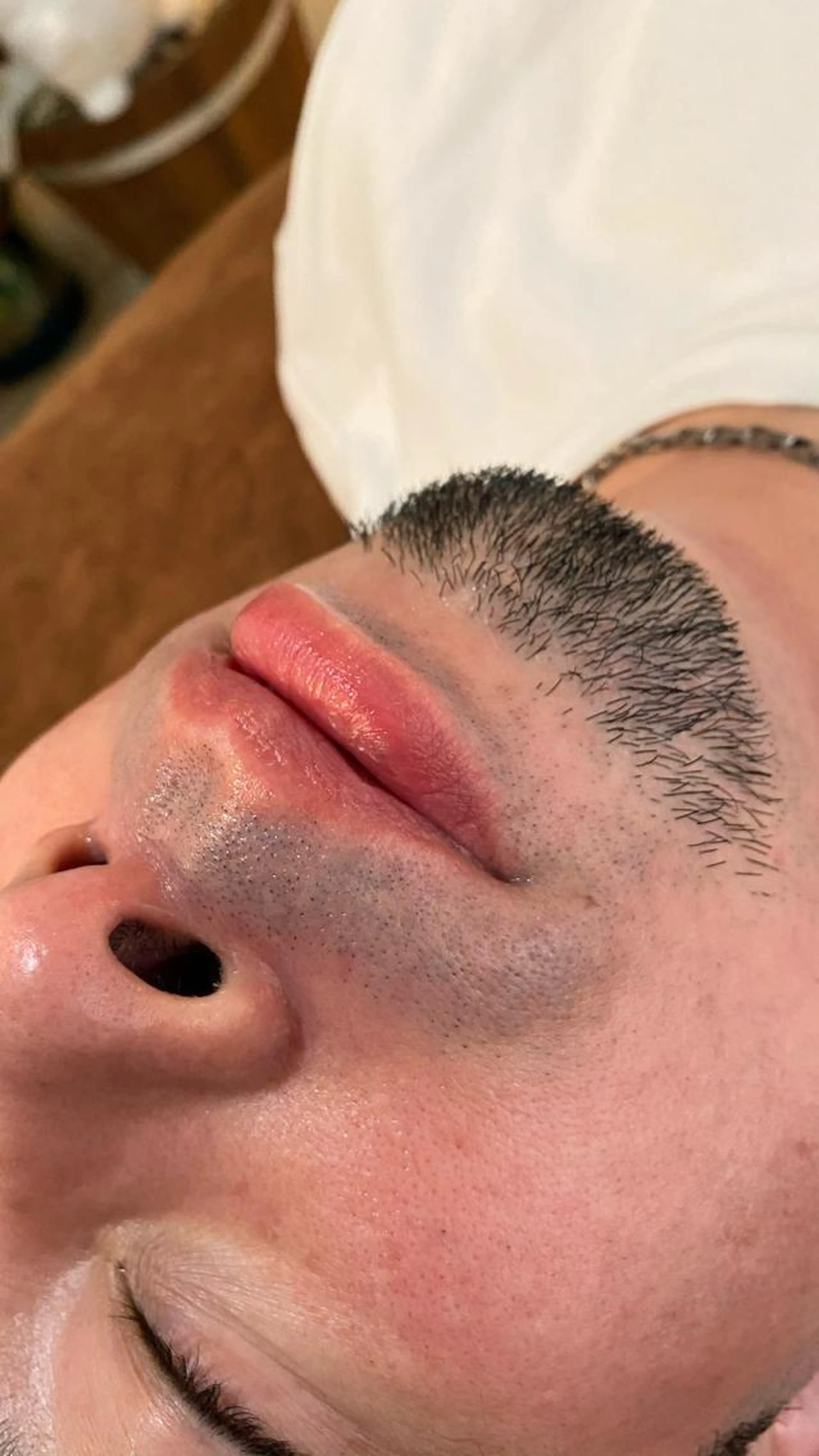 メンズ　男性限定　脱毛　ヒゲ脱毛　髭要らない方向けの写真