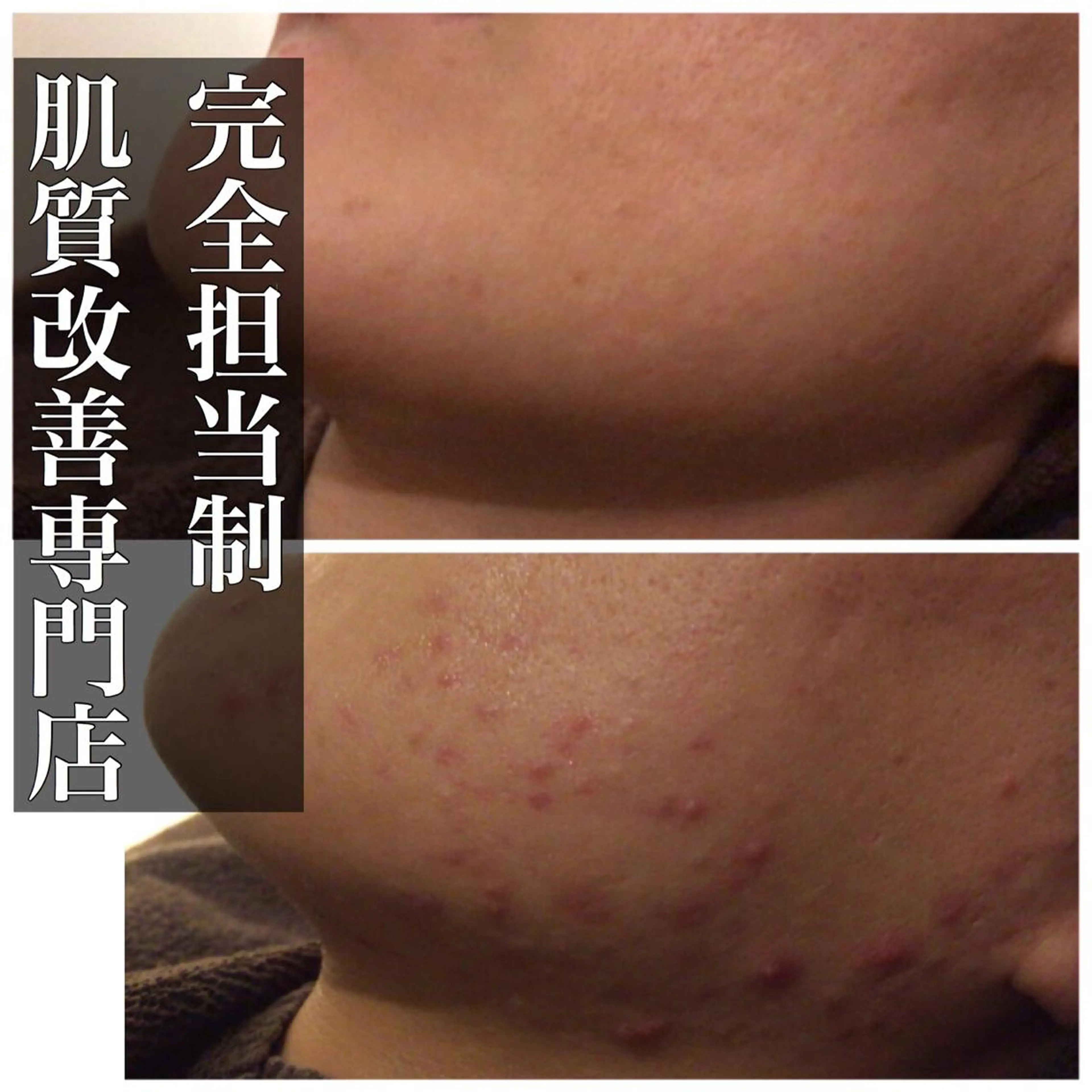 ミディアム カラー パーマ ヘアアレンジ メンズ キッズ ネイル マツエク・マツパ エステ リラク ニキビ・肌質改善専門 ♡人生が変わるサロンのエステ・リラクイメージ