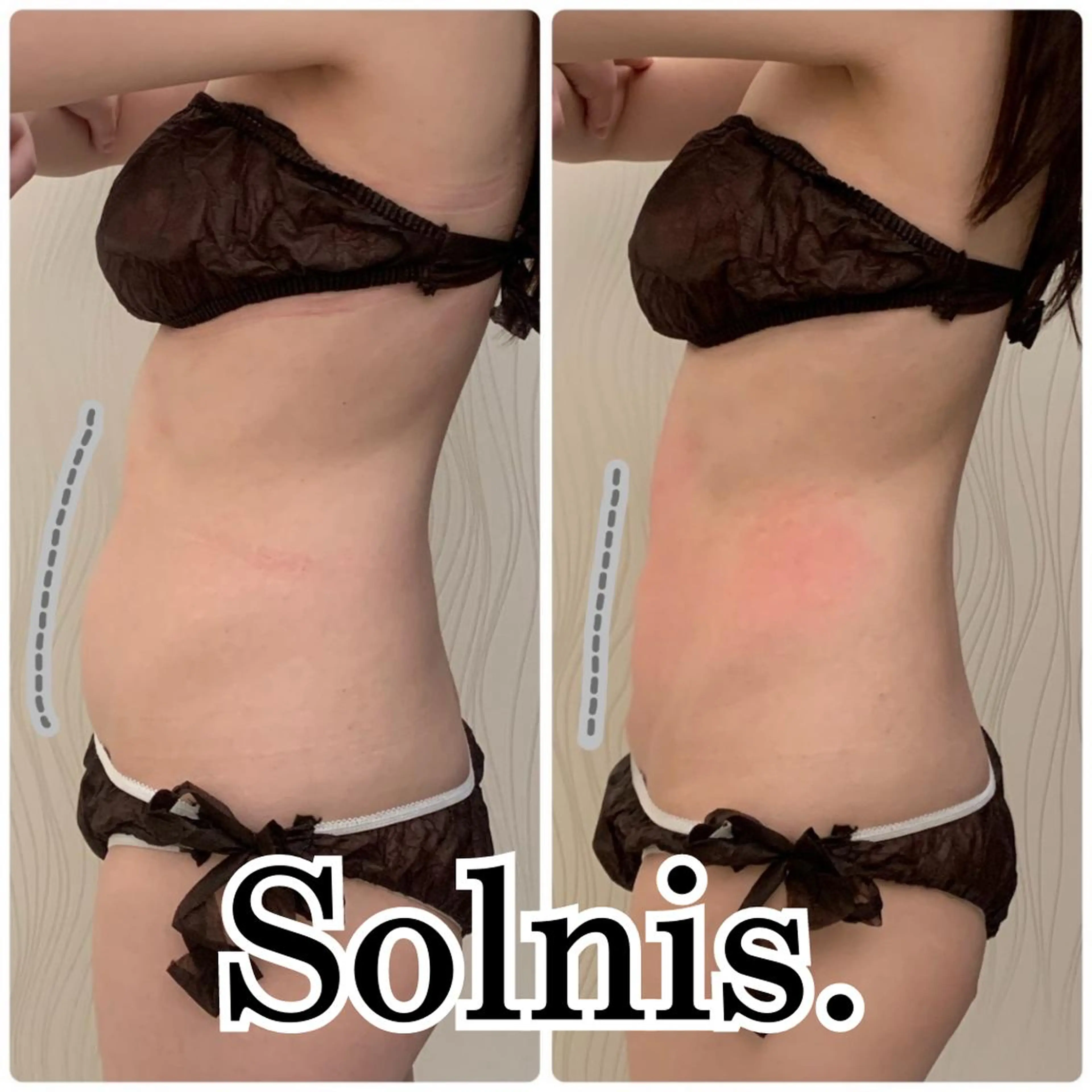 大阪市初！男性もok 酵素浴/痩身/小顔のその他イメージ