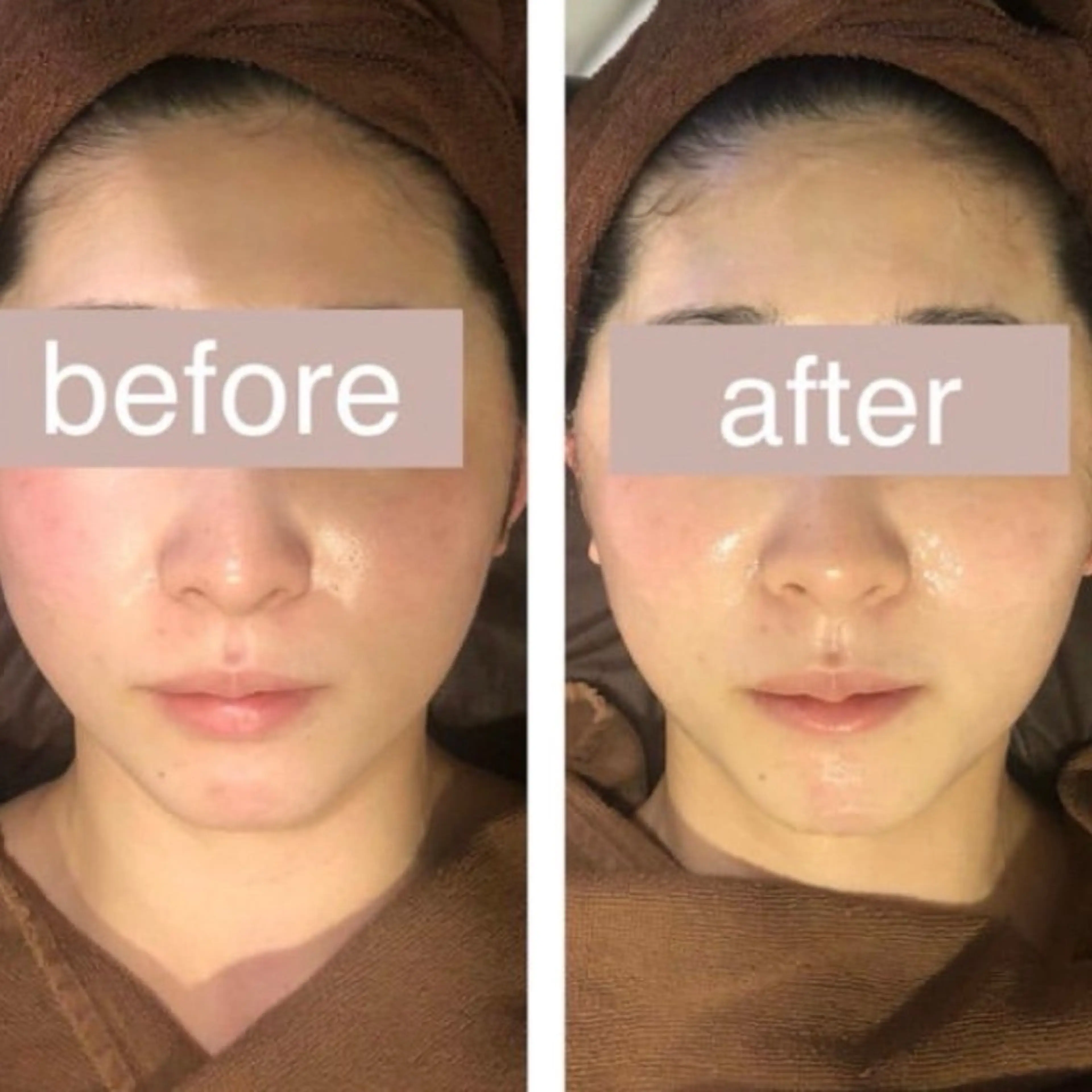 エステ 毛穴ニキビ専門 ビューティーグランツのエステ・リラクイメージ