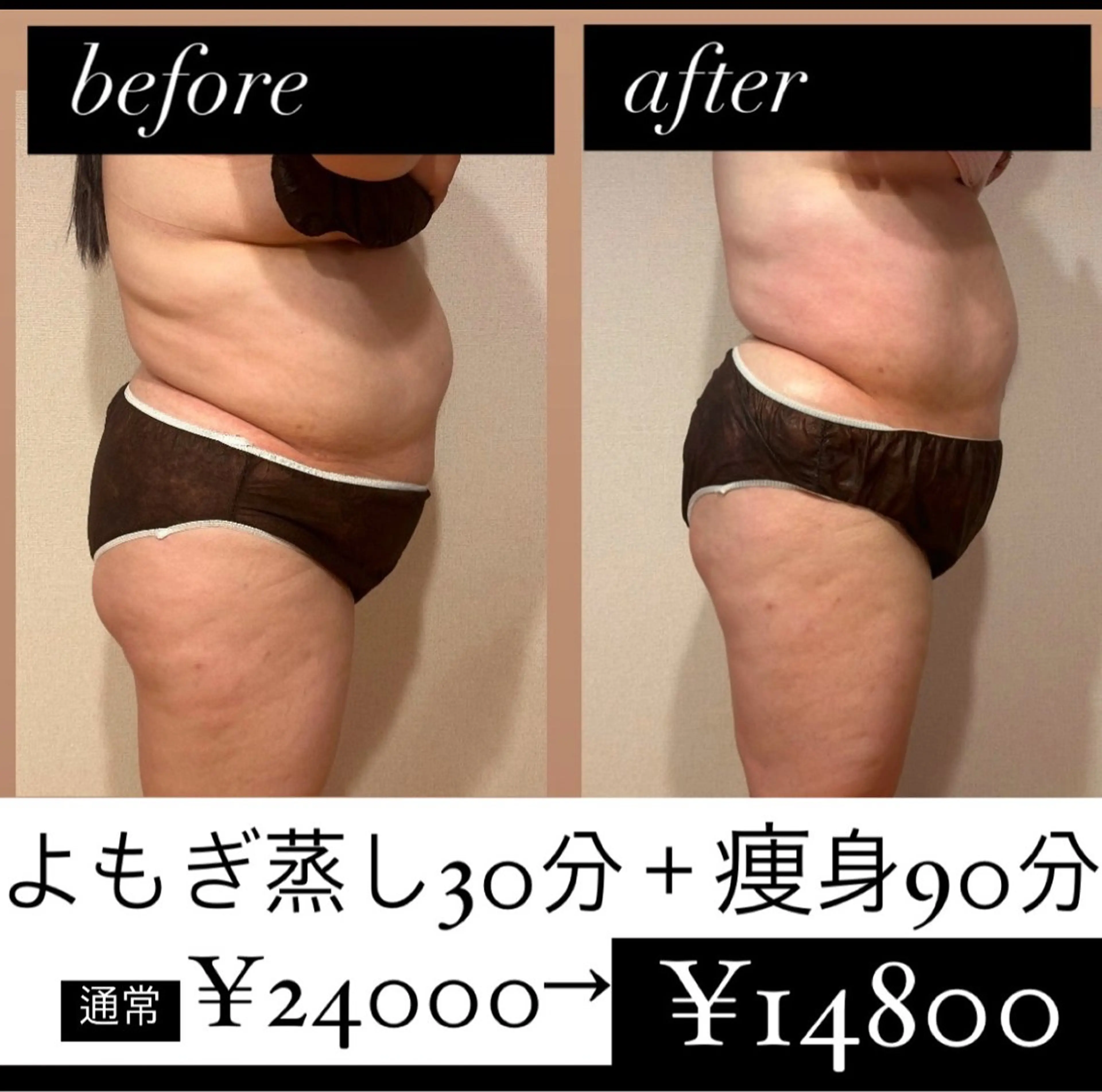 【全身徹底痩身】リバウンド無しの徹底痩身！凸凹脂肪に！よもぎ蒸し付！90分　お得な2回→¥24,800！！の写真