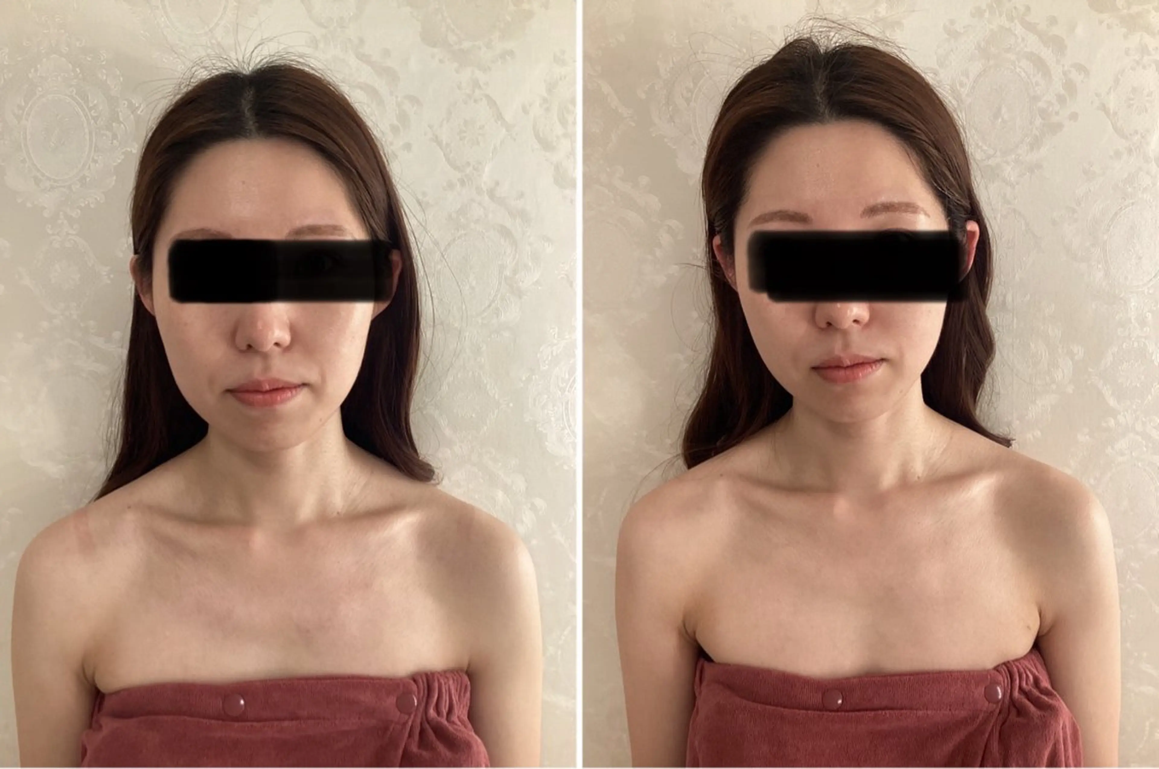 小顔矯正+フェイシャルリンパマッサージ+ヘッドスパ60分コースの写真