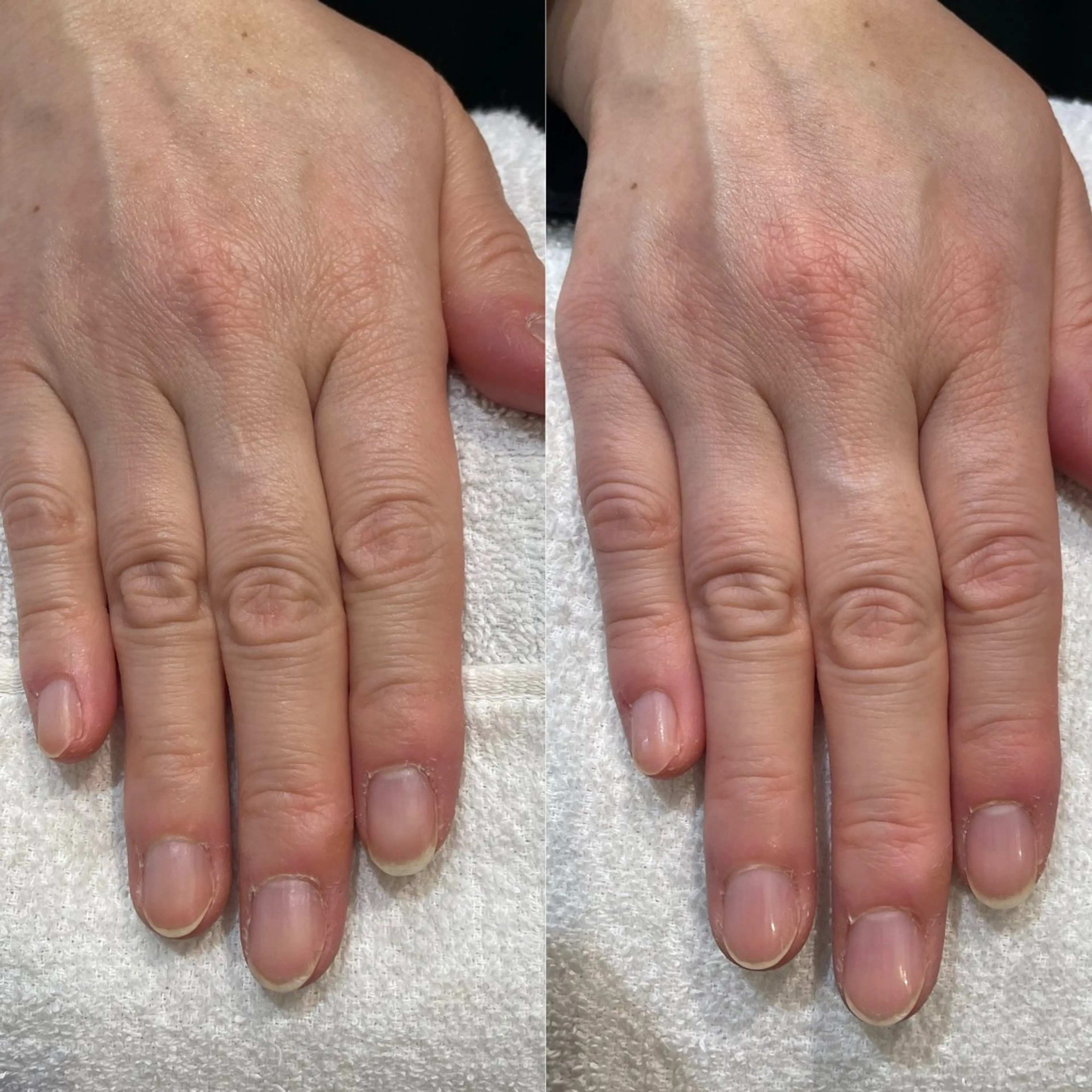 ネイル 痛くないシミ取り 【荻窪】石橋のヘアスタイル