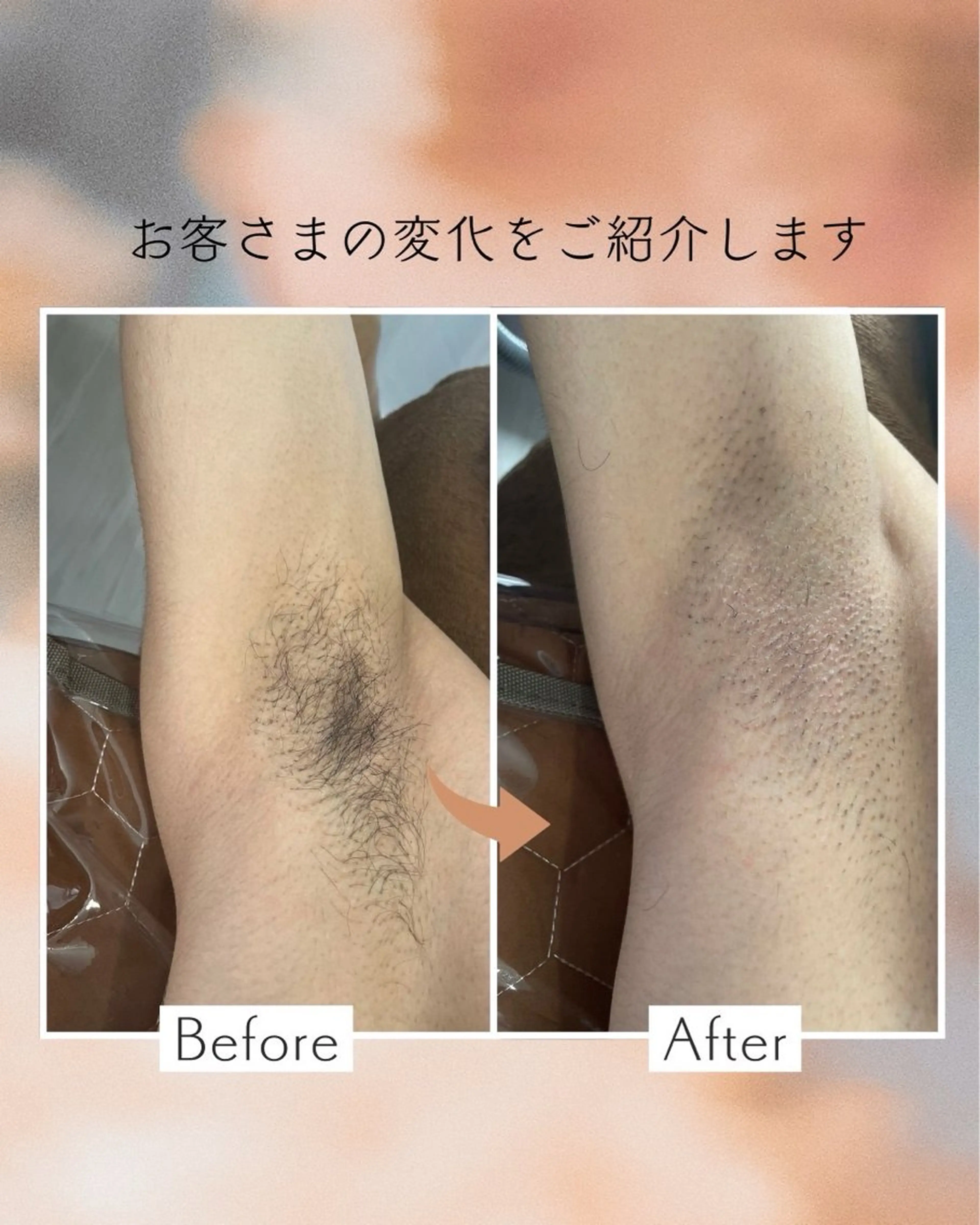 春日部 リダージュのエステ・リラクイメージ