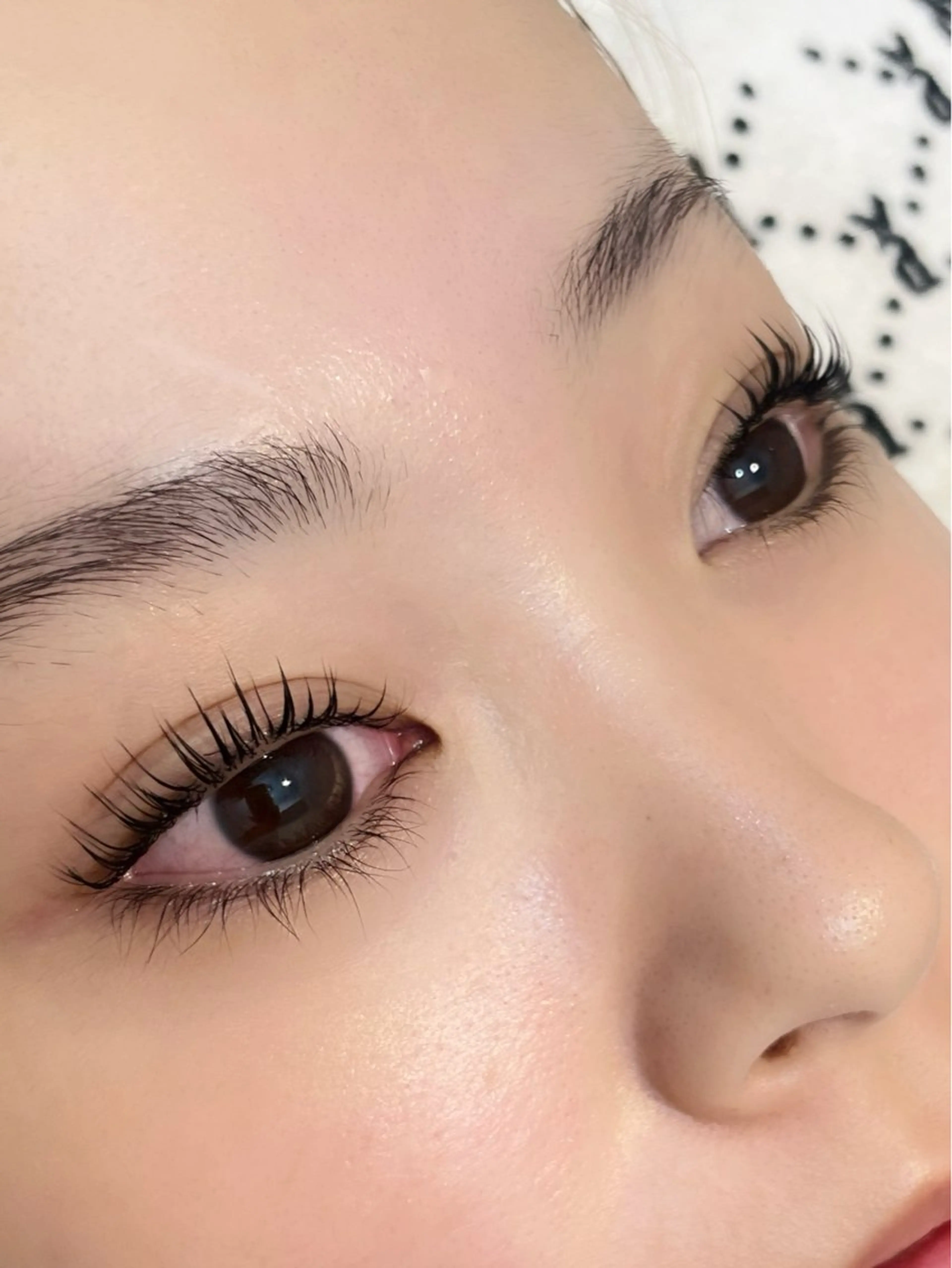 🎅Xmas限定クーポン🎄マツパ＋耳ツボ6粒の写真