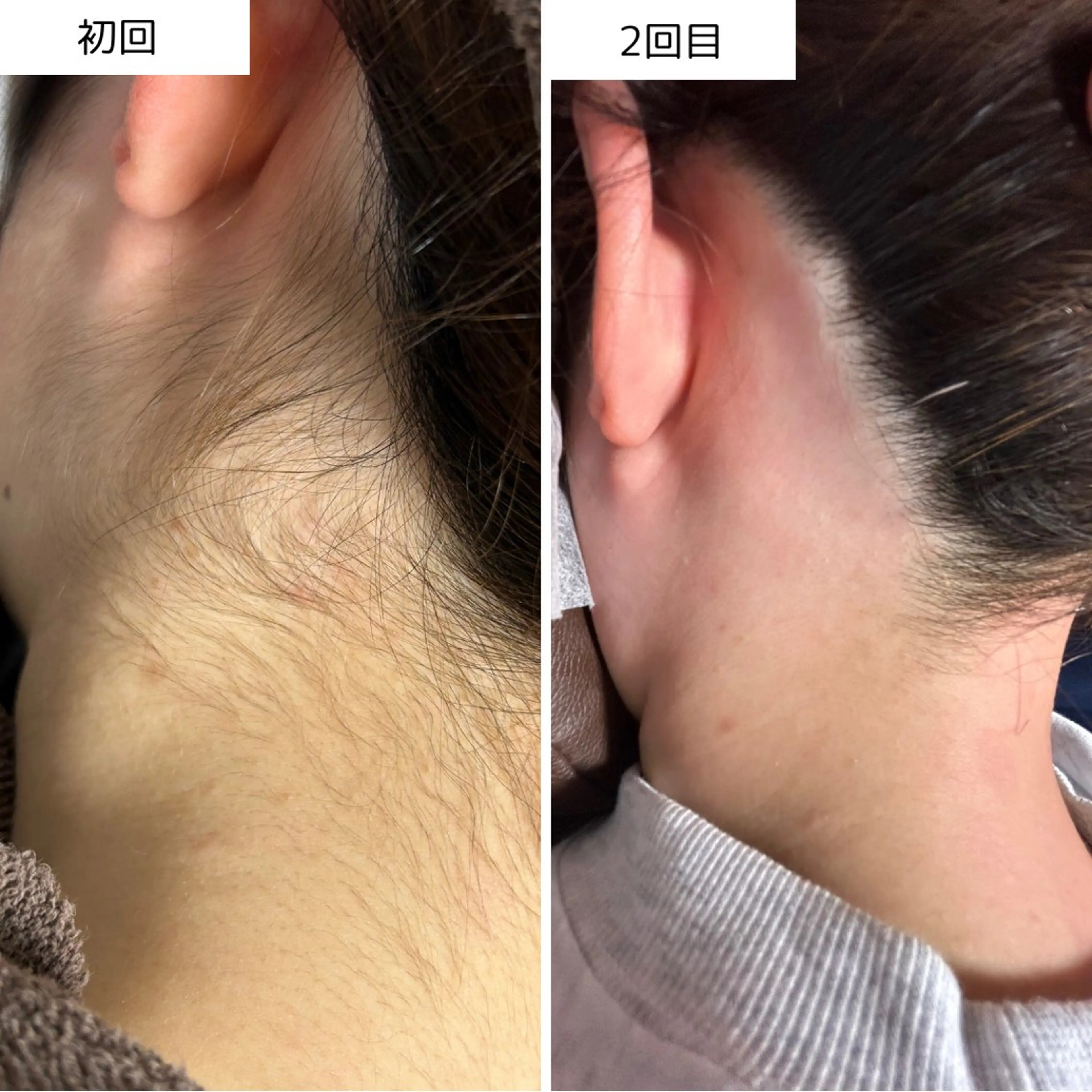 脱毛 Beauty  salon Lien所属・大村市Lien＊ 中川内翔子のエステ・リラクイメージ