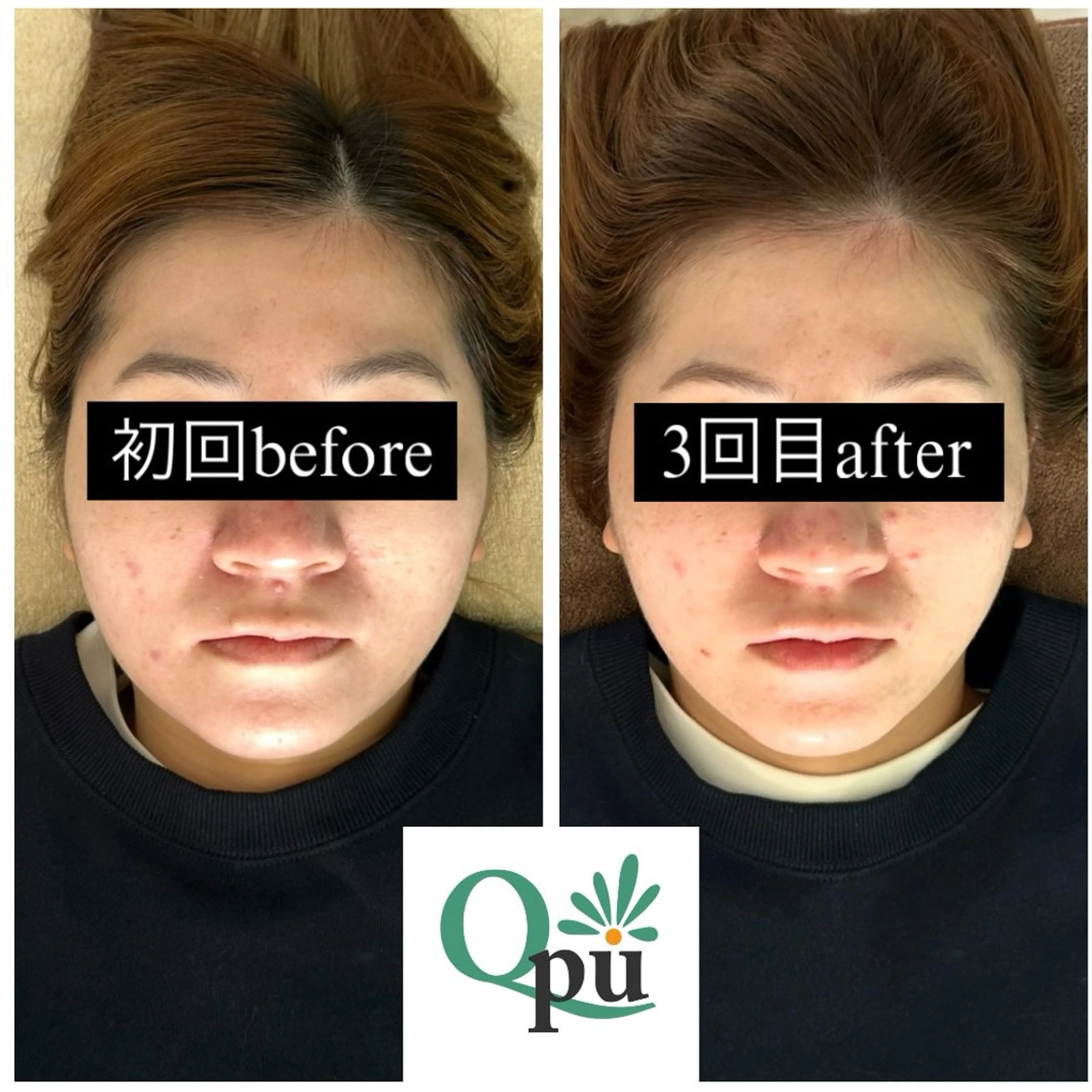 Qpu(キュープ)下北沢店所属・鮎川 さゆりのエステ・リラクイメージ