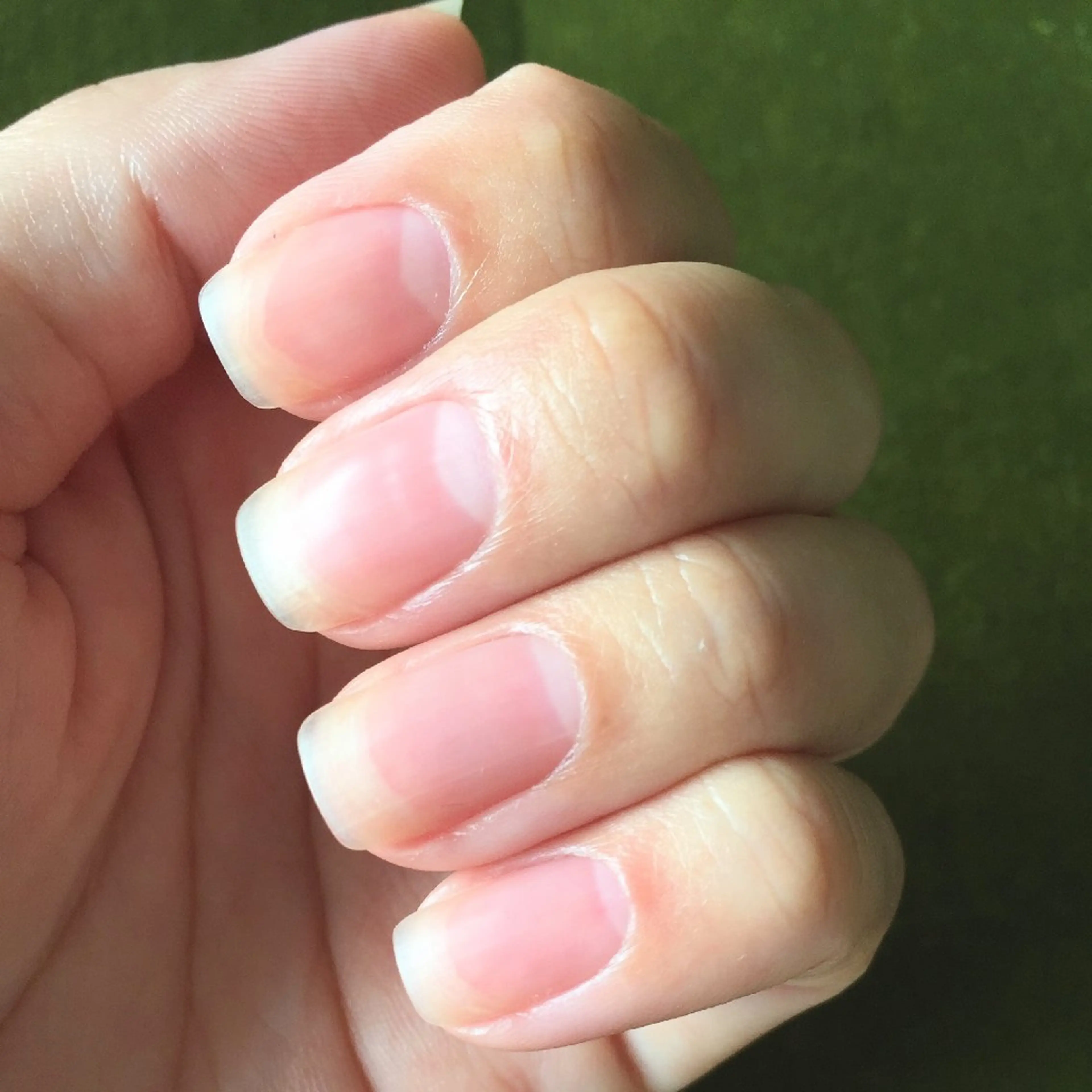 ネイル オフのみ(ネイル) 深爪矯正/爪育成ケア manie nailのネイルデザイン