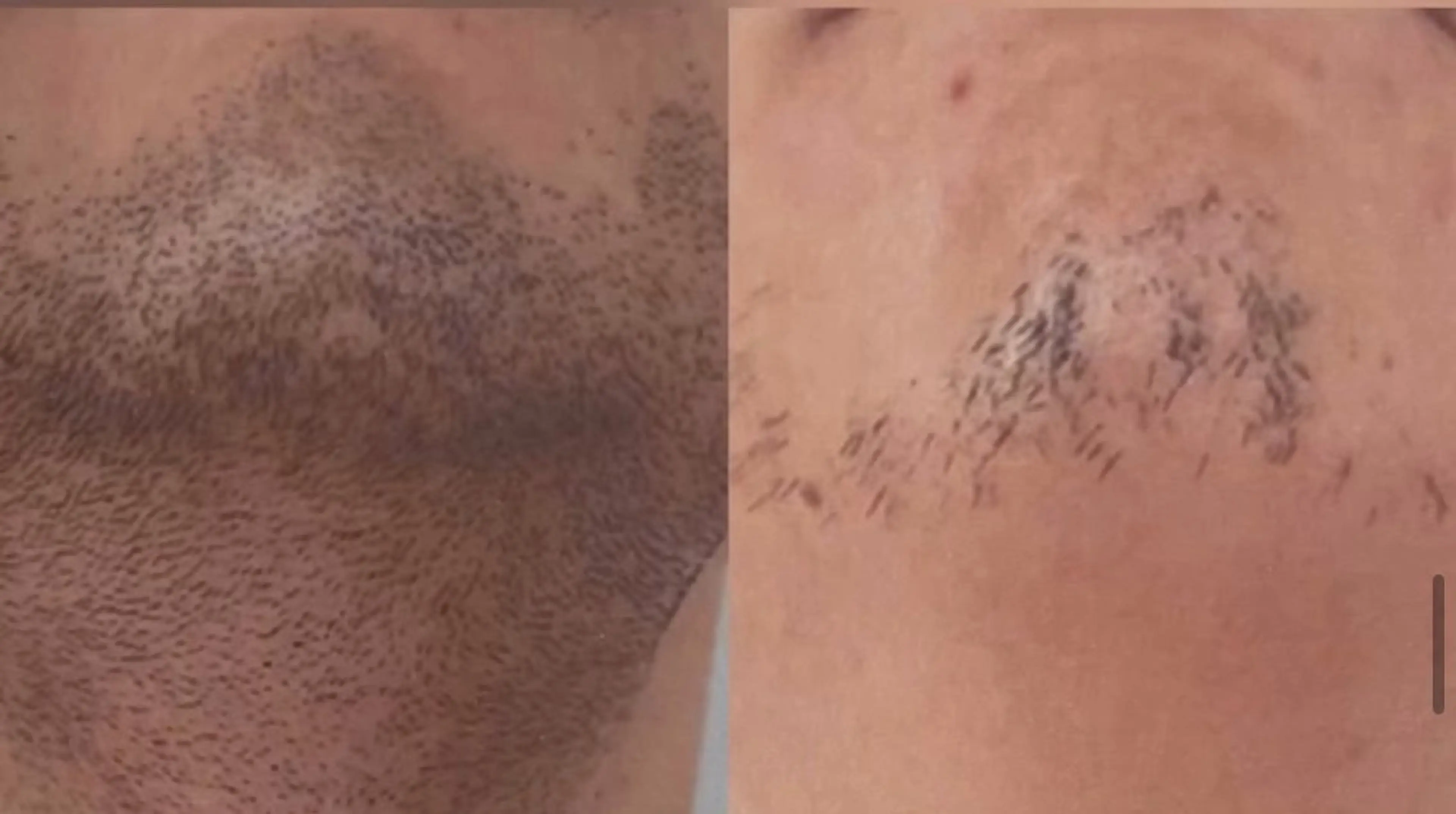 メンズ エルモサ痩身脱毛 西八王子店所属・エルモサ痩身脱毛 西八王子店のエステ・リラクイメージ