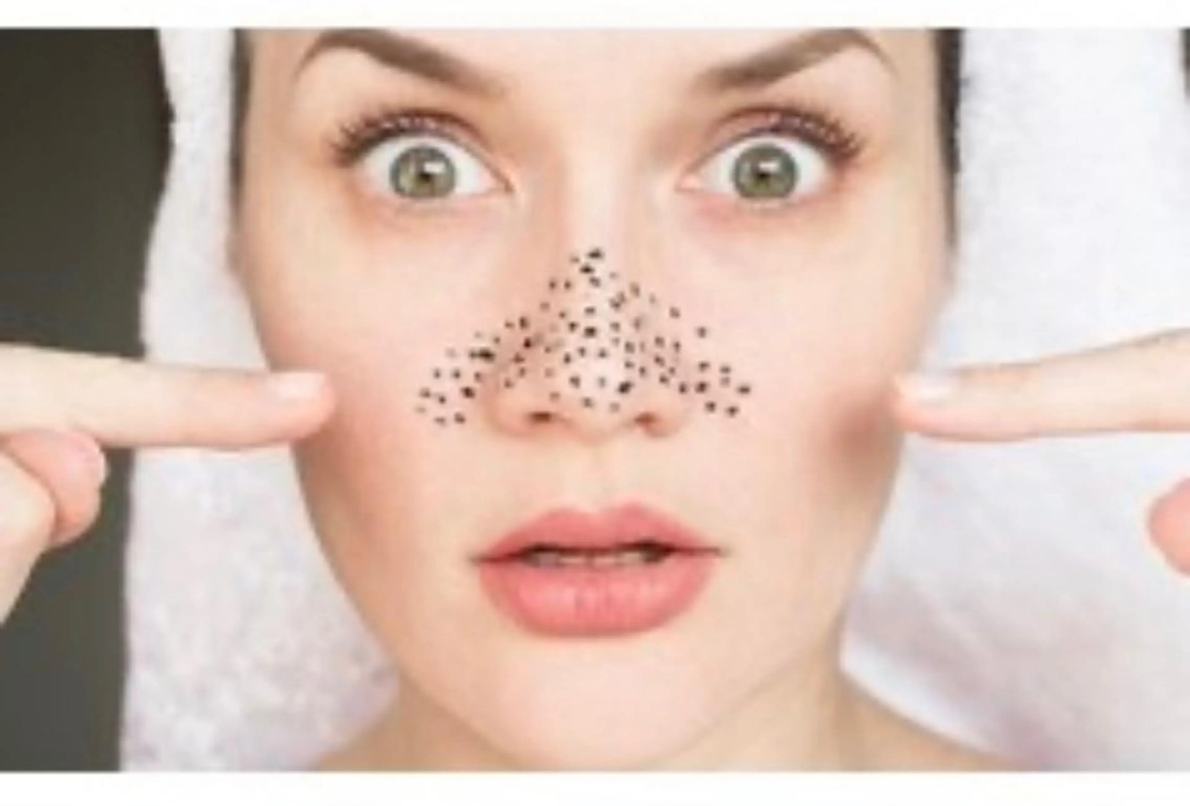 オーヴル毛穴プレミアム(新規来店のお客様のみ)の写真