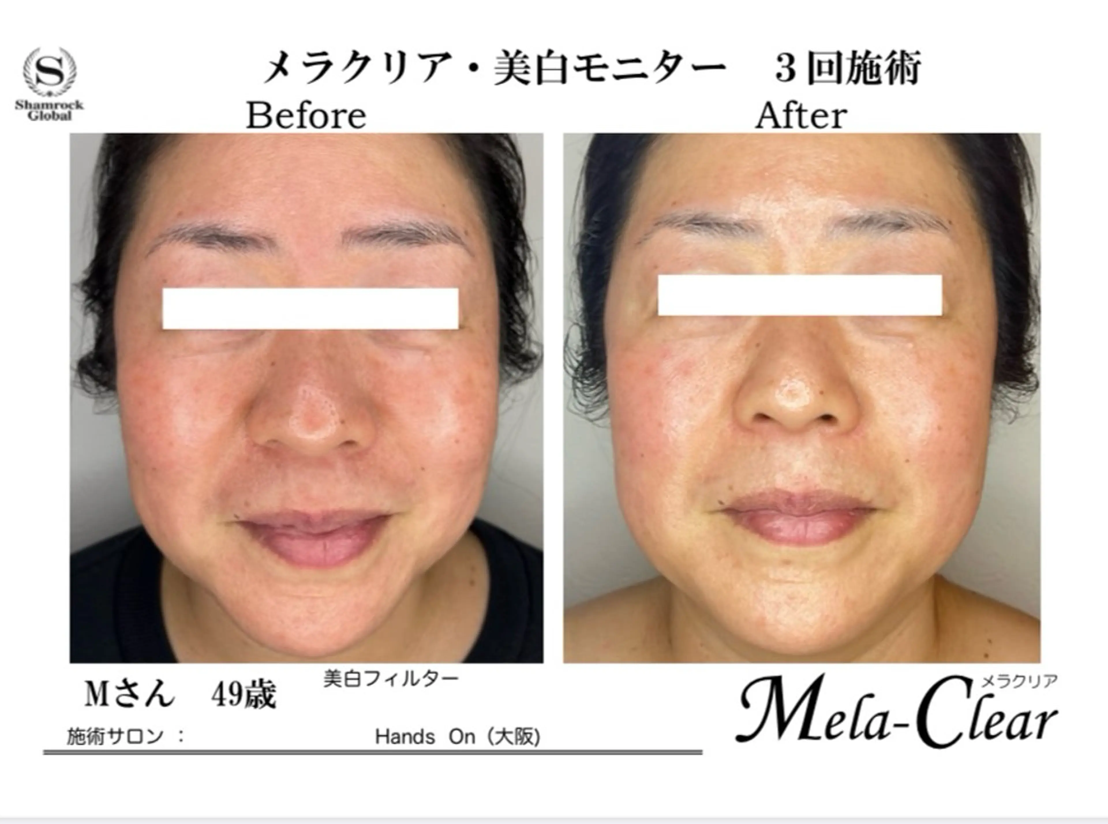 光フォト美容 エイジング、敏感肌のエステ・リラクイメージ