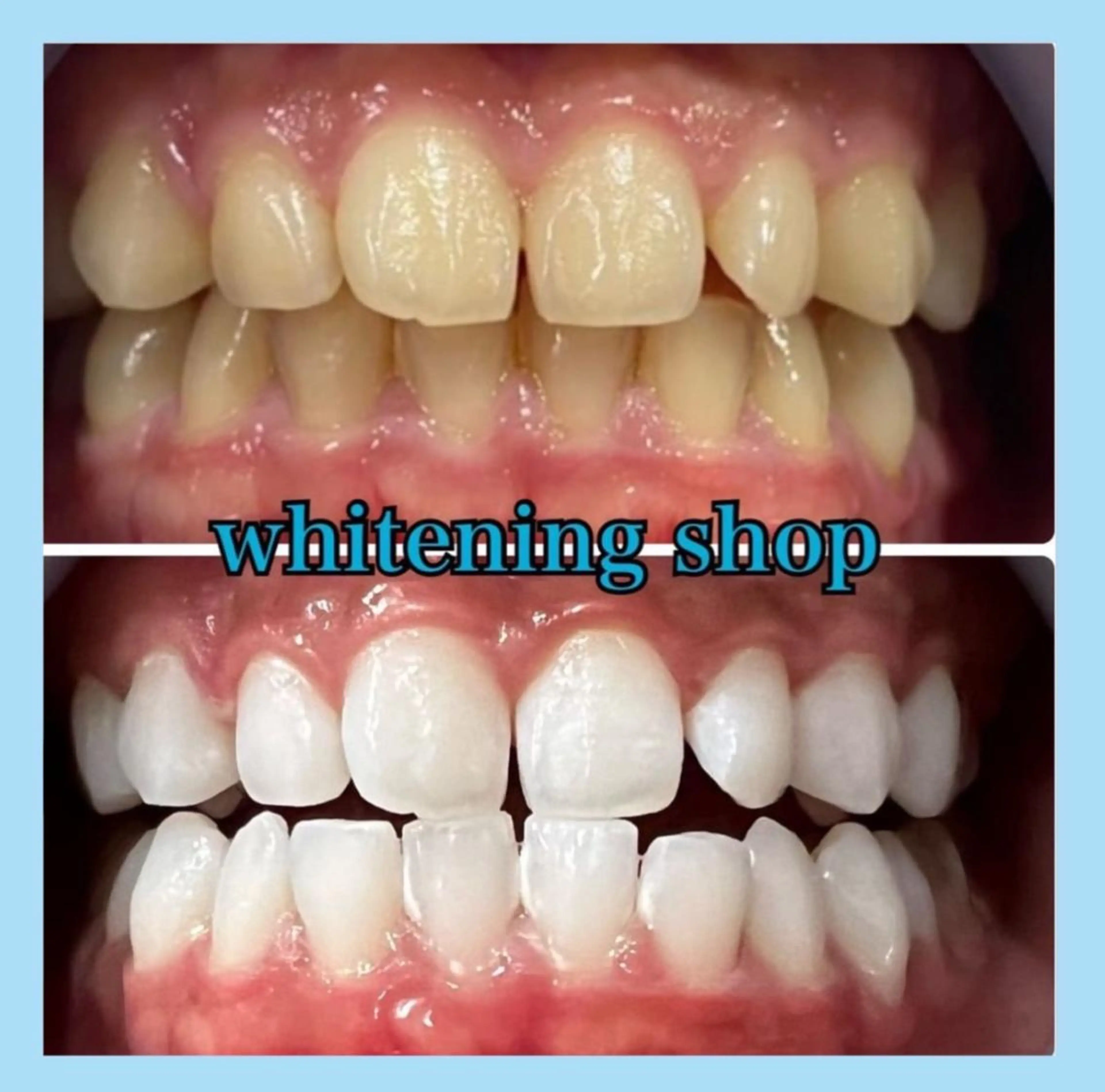 ホワイトニング ショップ千葉店のその他イメージ