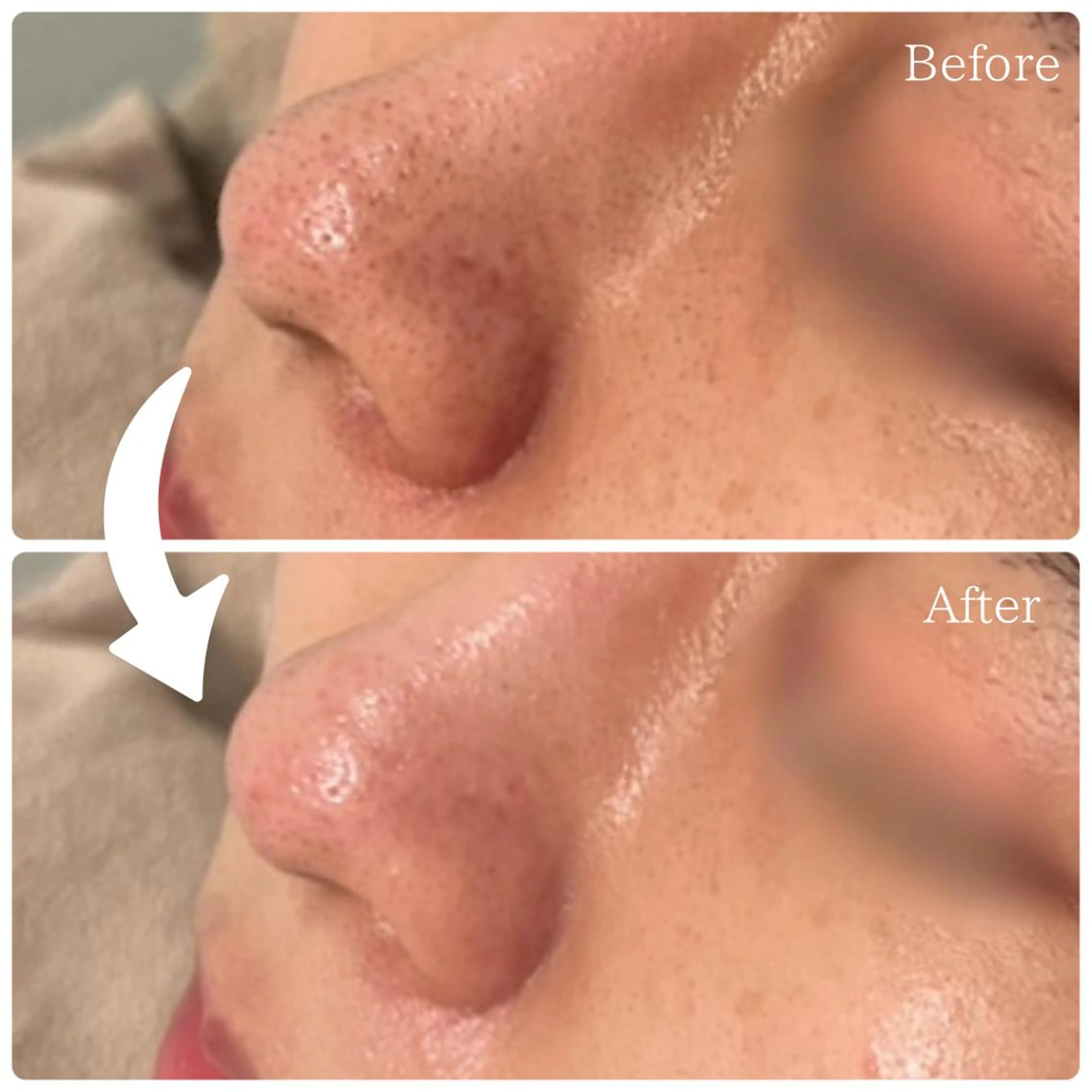 エステ MiMiy 銀座店のエステ・リラクイメージ