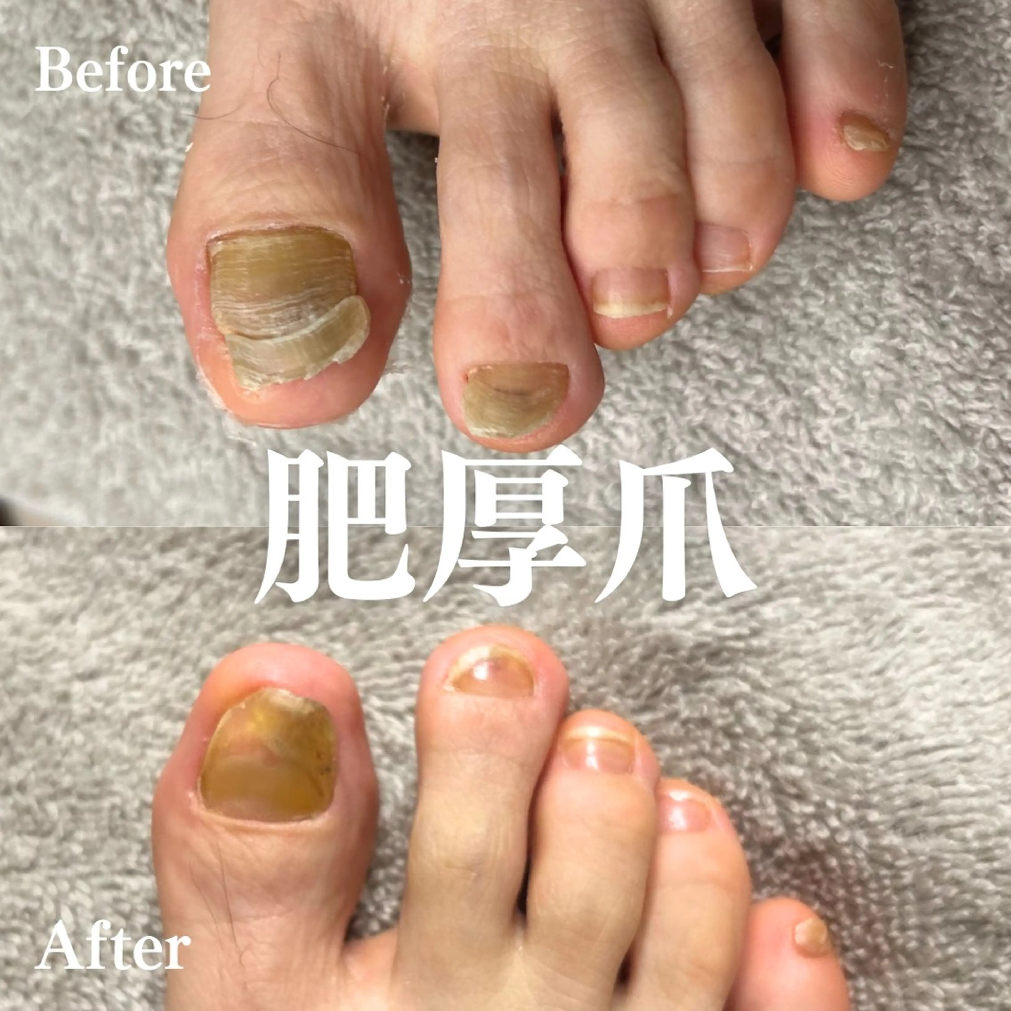 Foot Care Salon Coco 拝島店所属・Foot Salon -Coco-拝島店のエステ・リラクイメージ