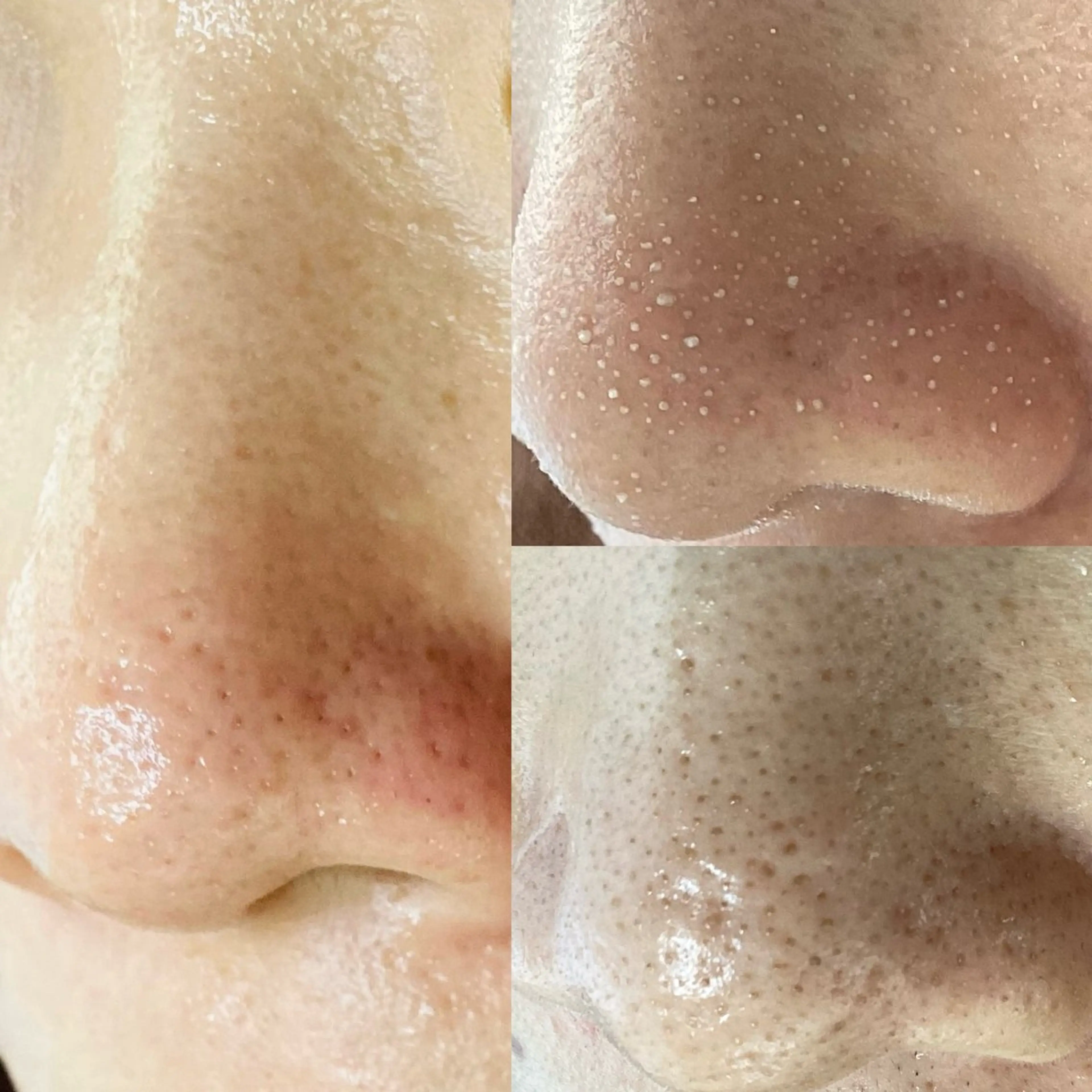 Rifuro毛穴ケア &よもぎ蒸しサロンのエステ・リラクイメージ