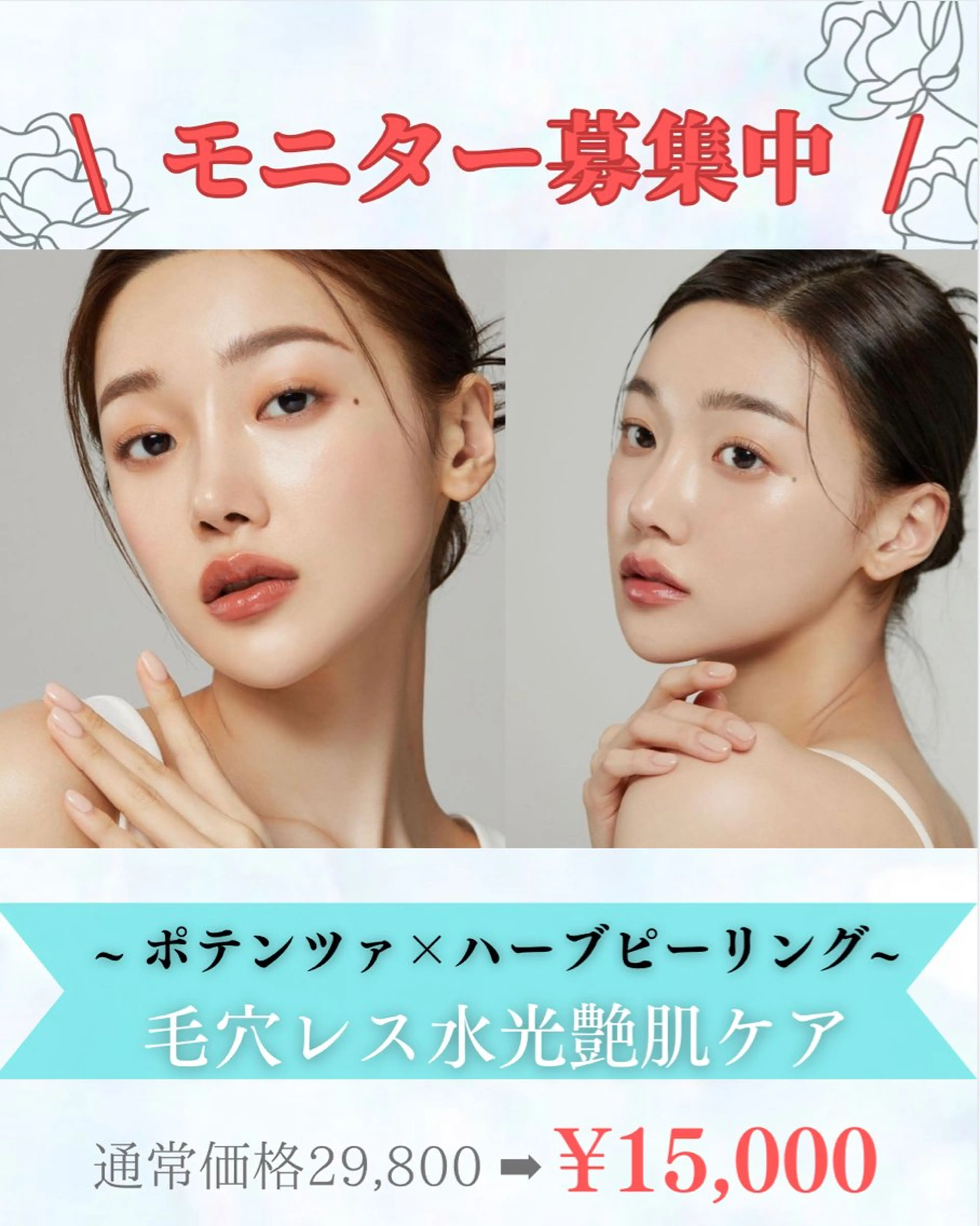 【ポテンツァ マイクロニードル使用】ニキビ ニキビ跡 毛穴に効果的❣️ エクソソーム導入×ハーブピーリング同時施術‼️の写真