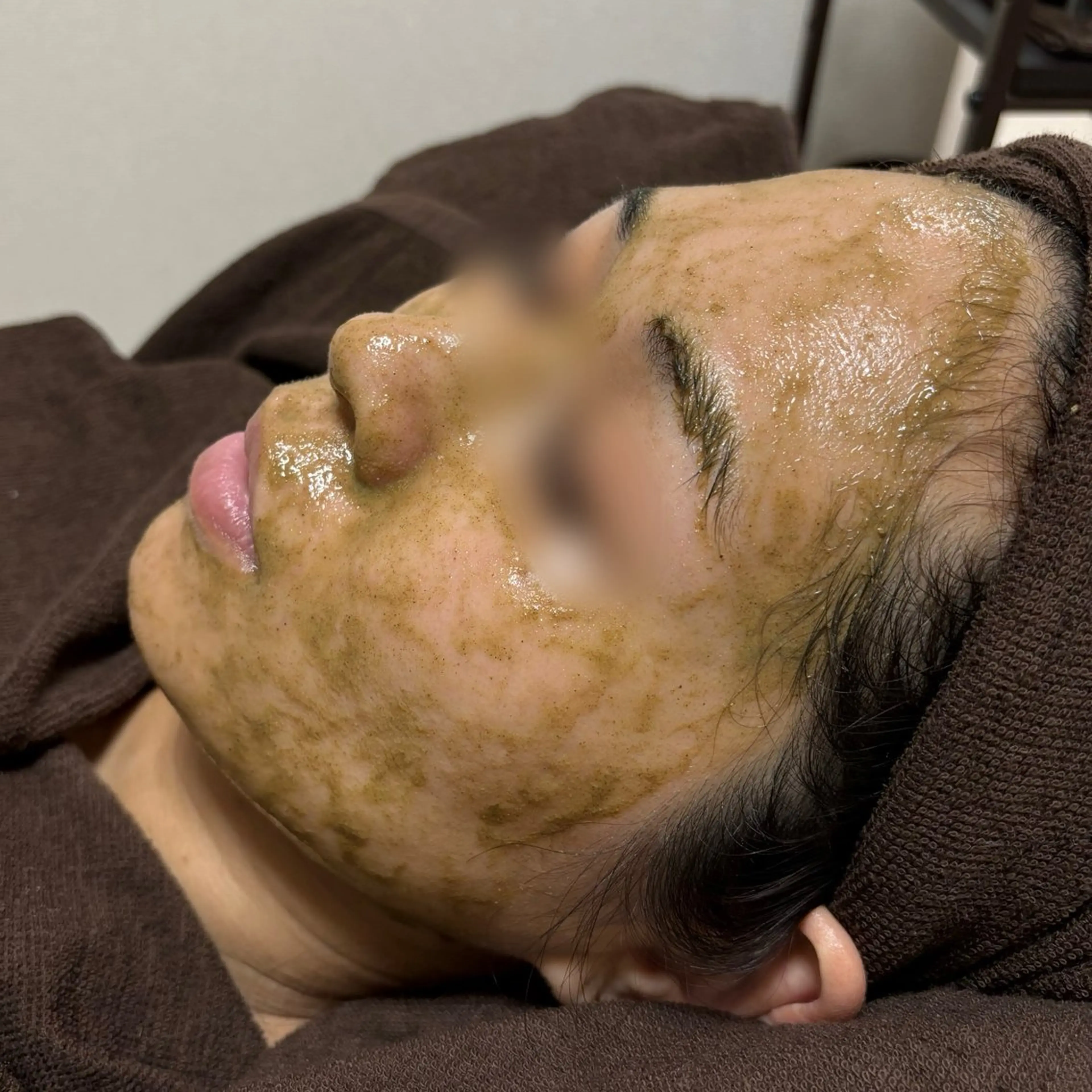 肌質改善Charme coco  増毛のエステ・リラクイメージ