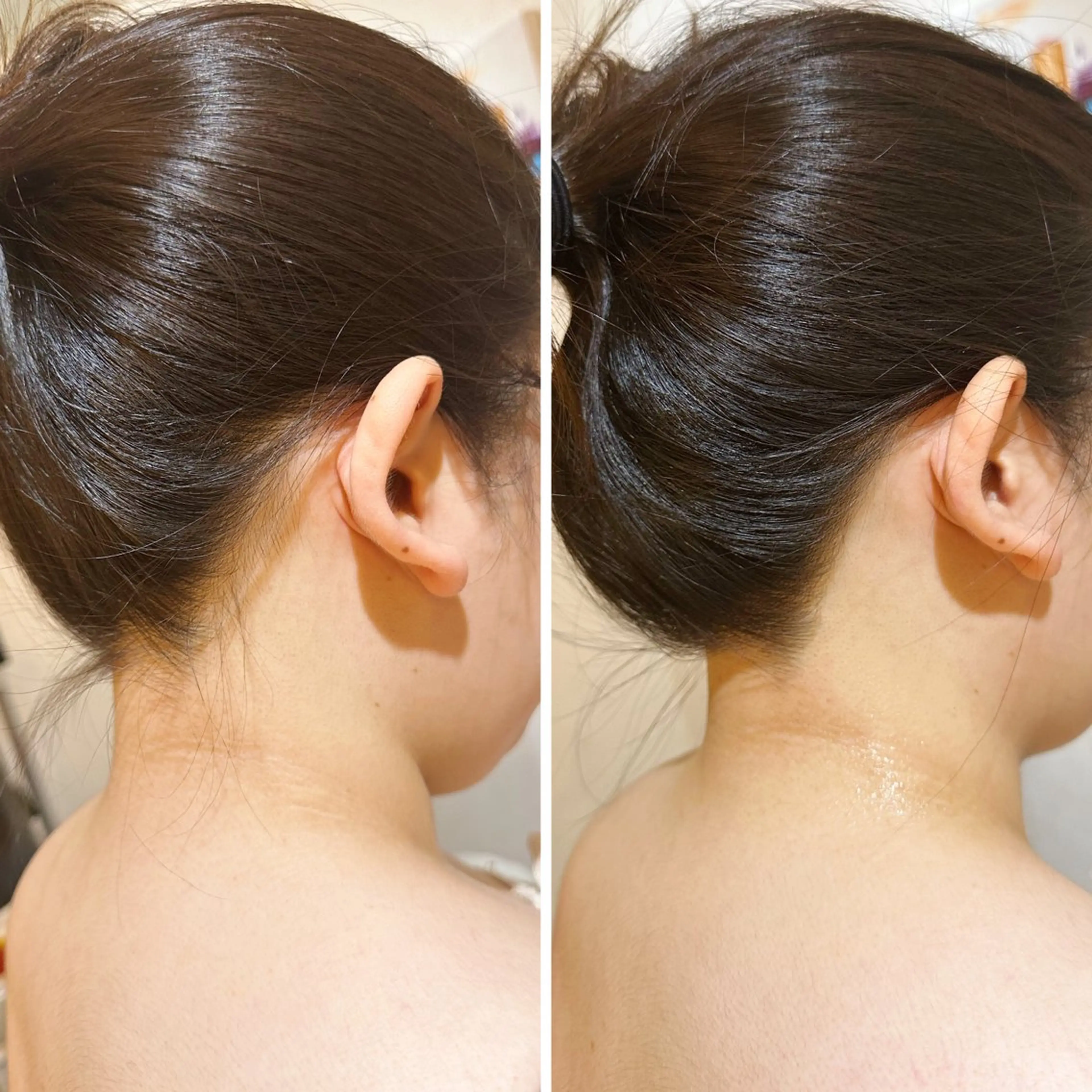 うなじ脱毛/美肌脱毛 LABELのエステ・リラクイメージ