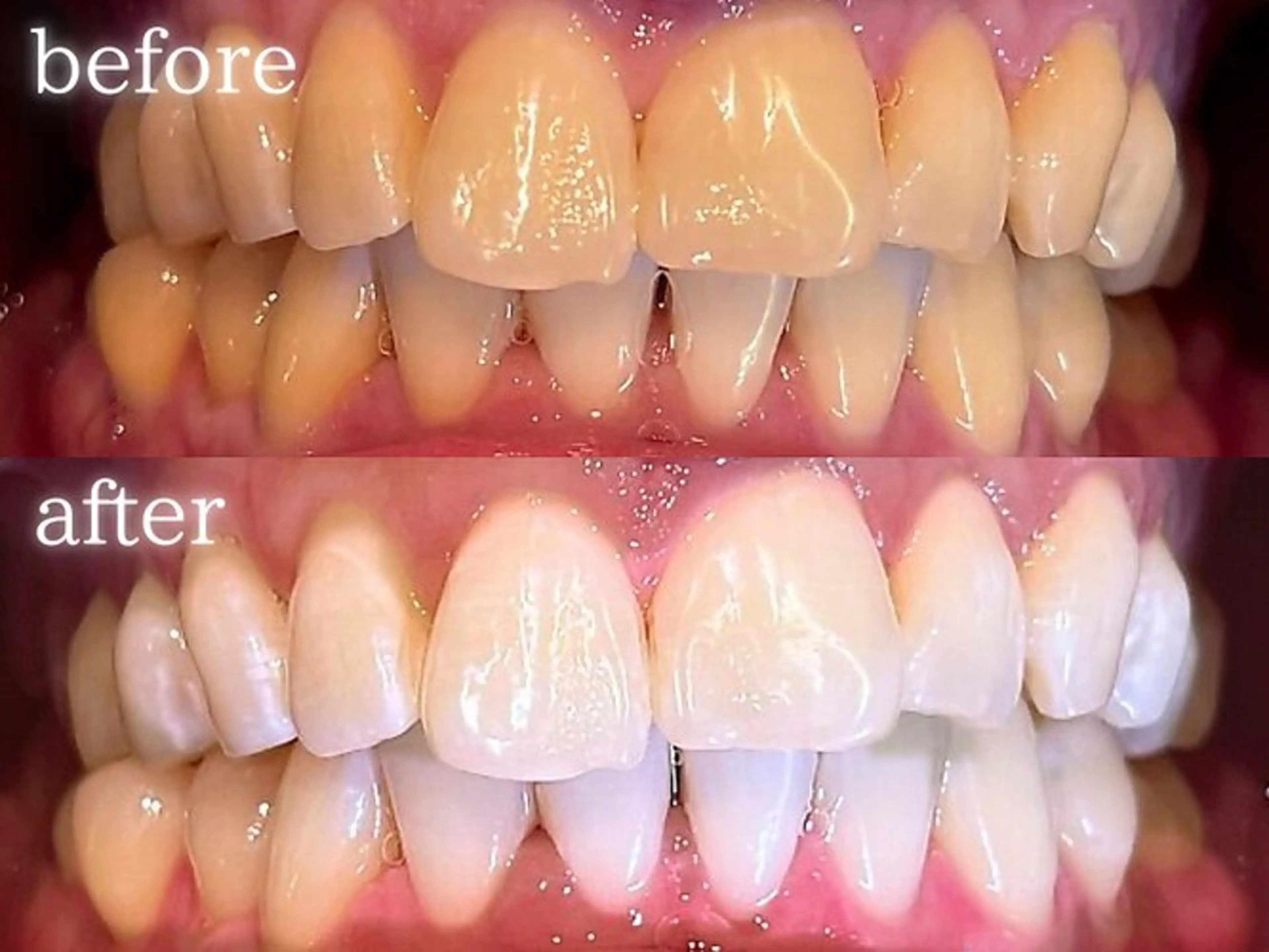 エミルカ　自由が丘店所属・ニキビ改善ハーブ🌿 ハナシマのその他イメージ