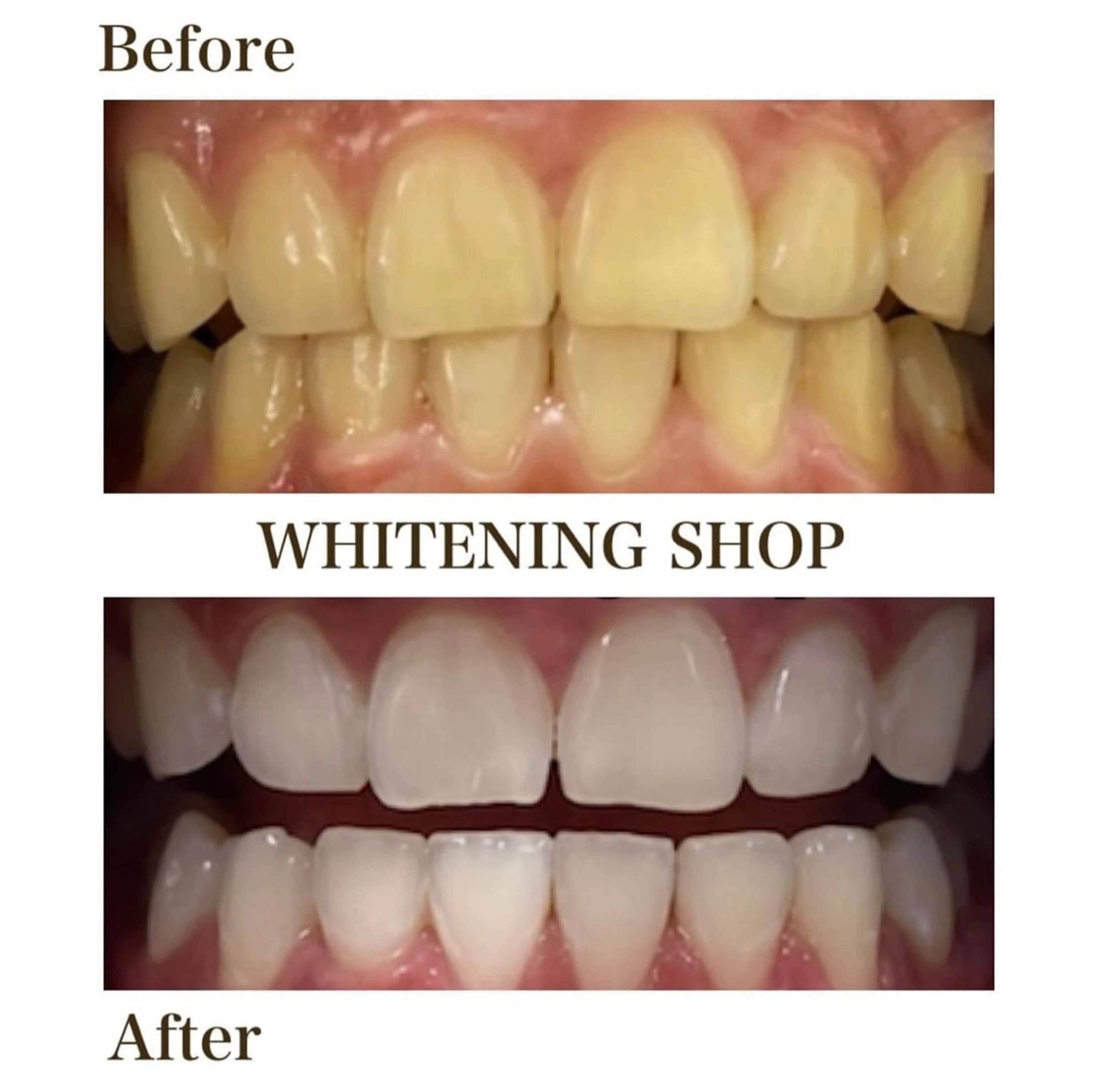 ホワイトニングショップ伊丹店所属・ホワイトニング ショップ伊丹店のその他イメージ