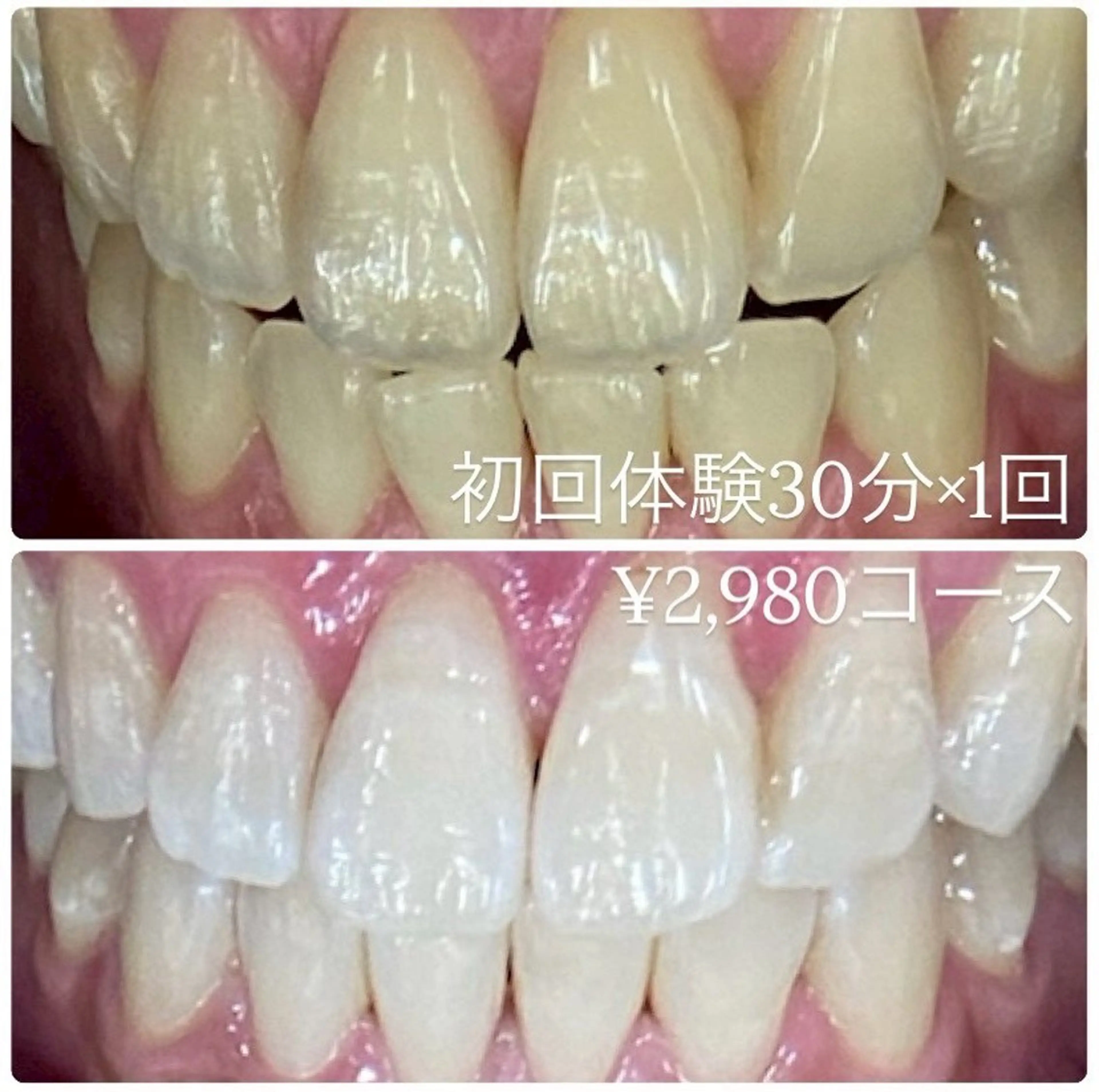 メンズ その他 ホワイトニングルーム　川崎店所属・ホワイトニング ルーム　川崎店のその他イメージ