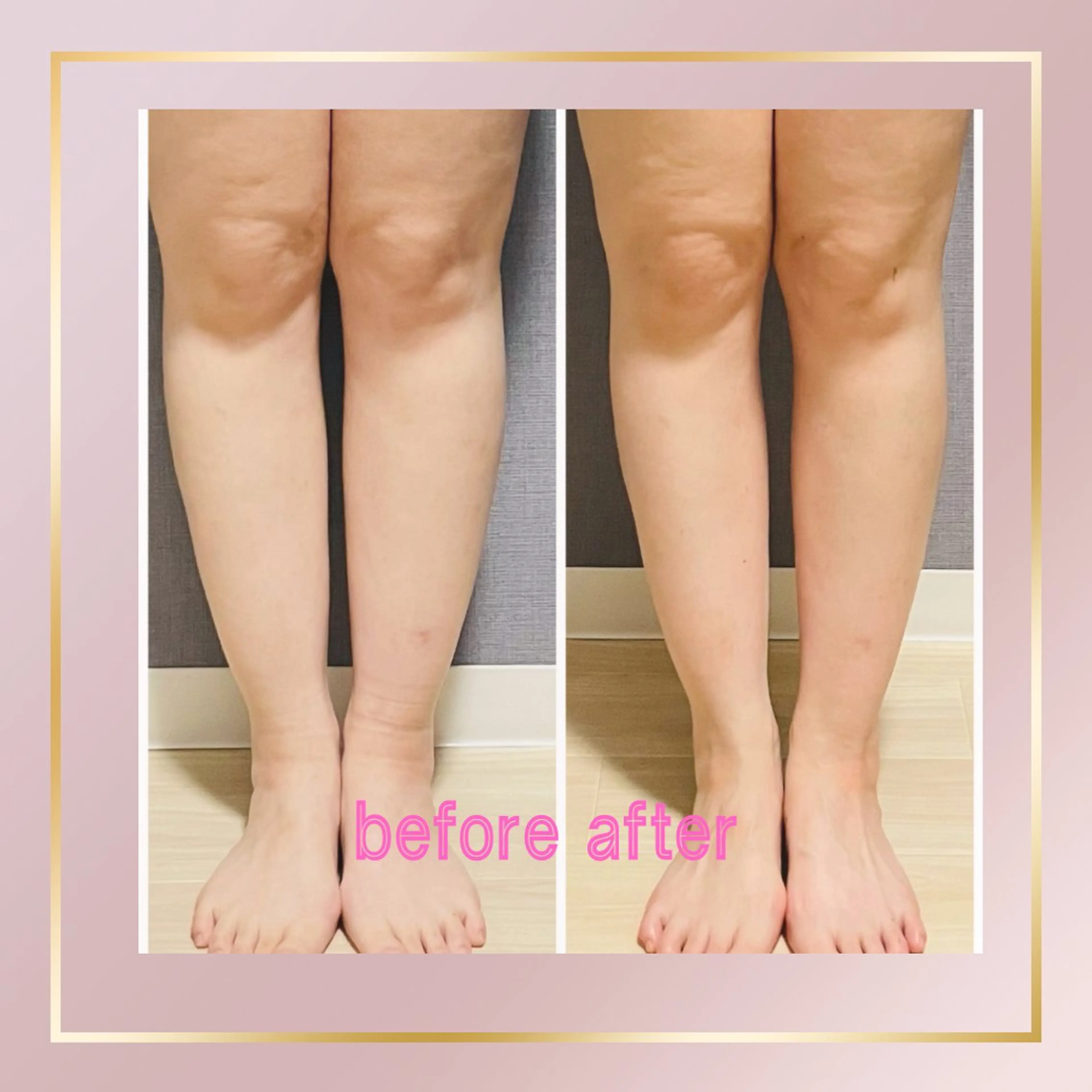 天満/asami/ 優しい筋膜リリースのエステ・リラクイメージ