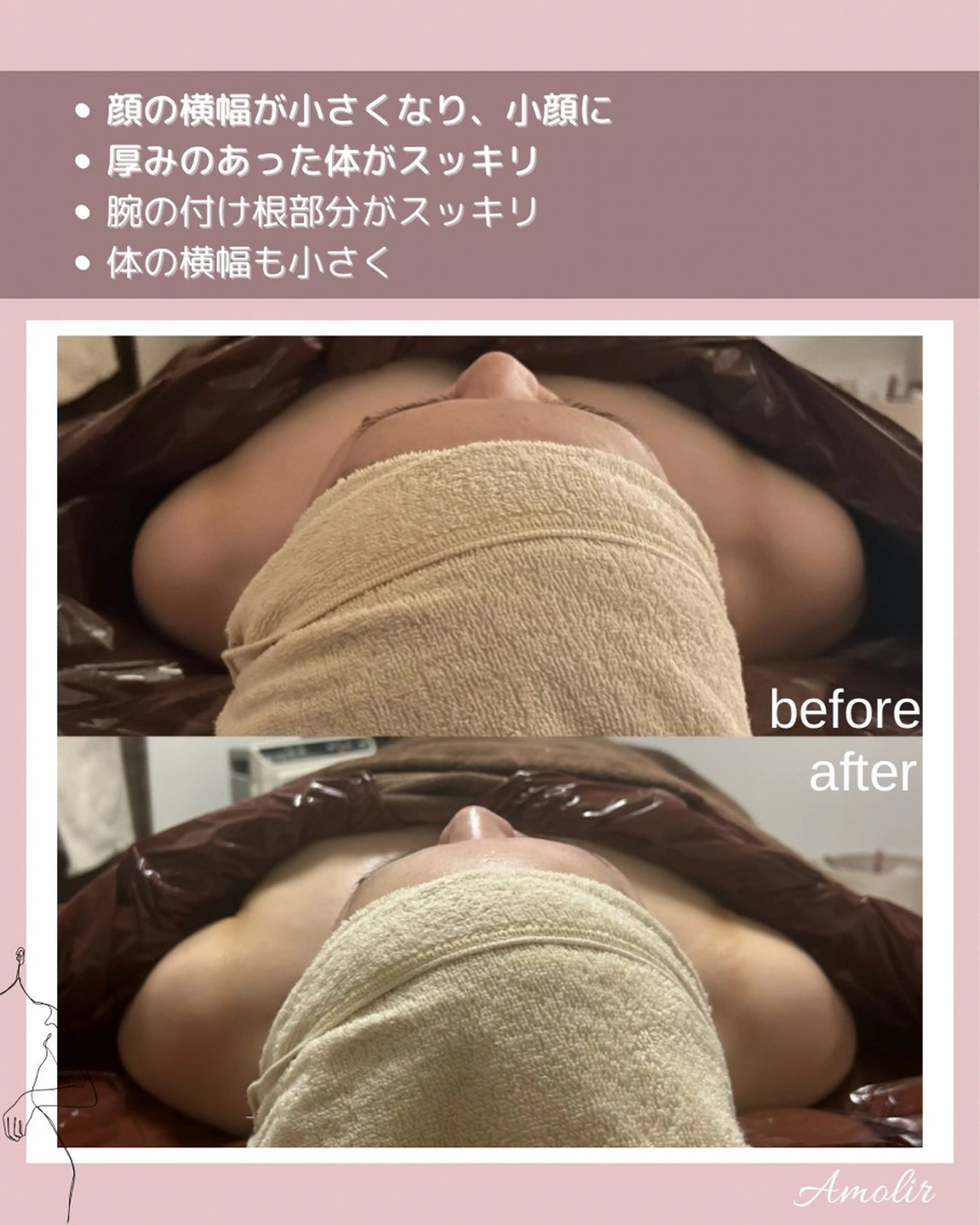 30代以降のボディ メイク Amolirのエステ・リラクイメージ