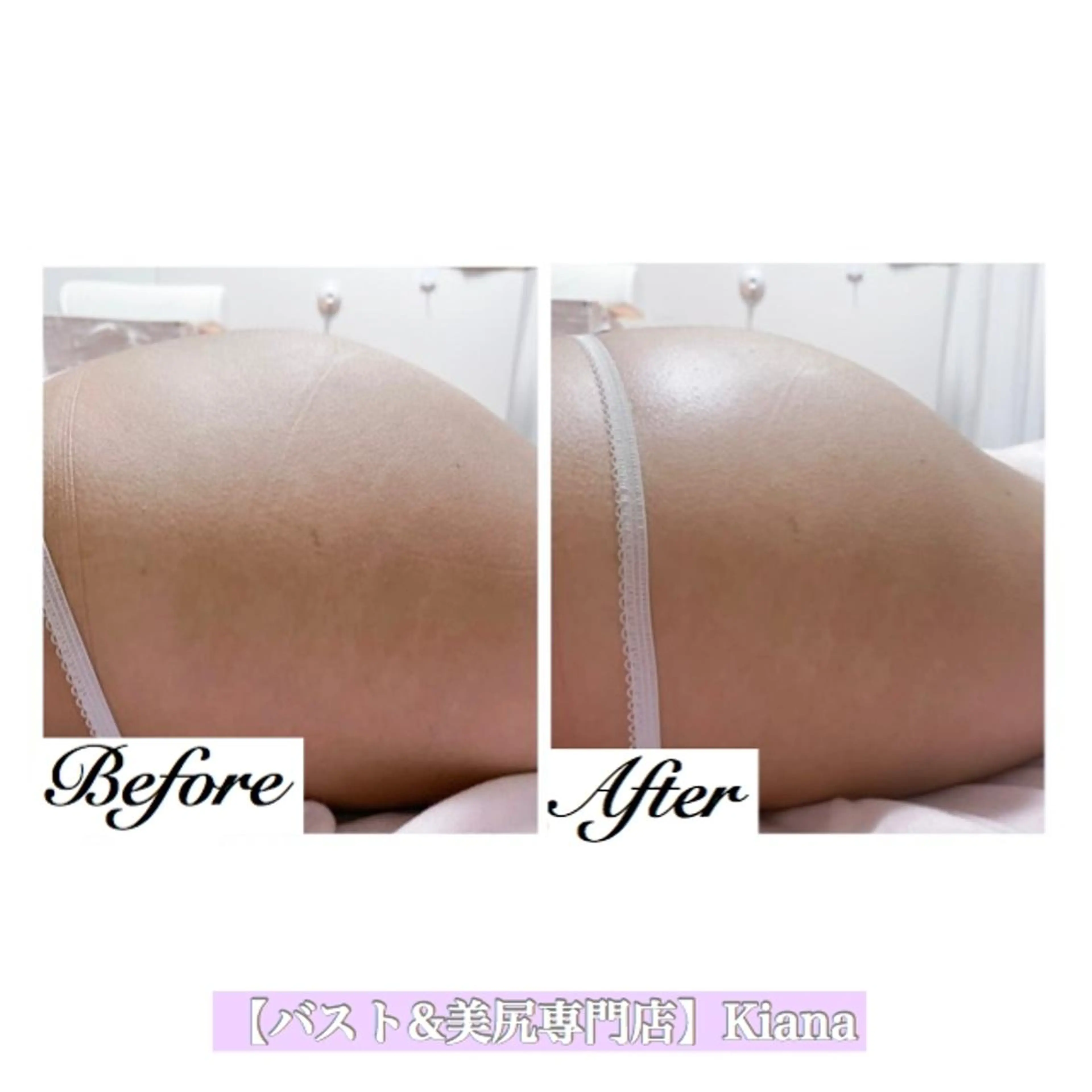 【バスト専門店 】 Kiana のエステ・リラクイメージ
