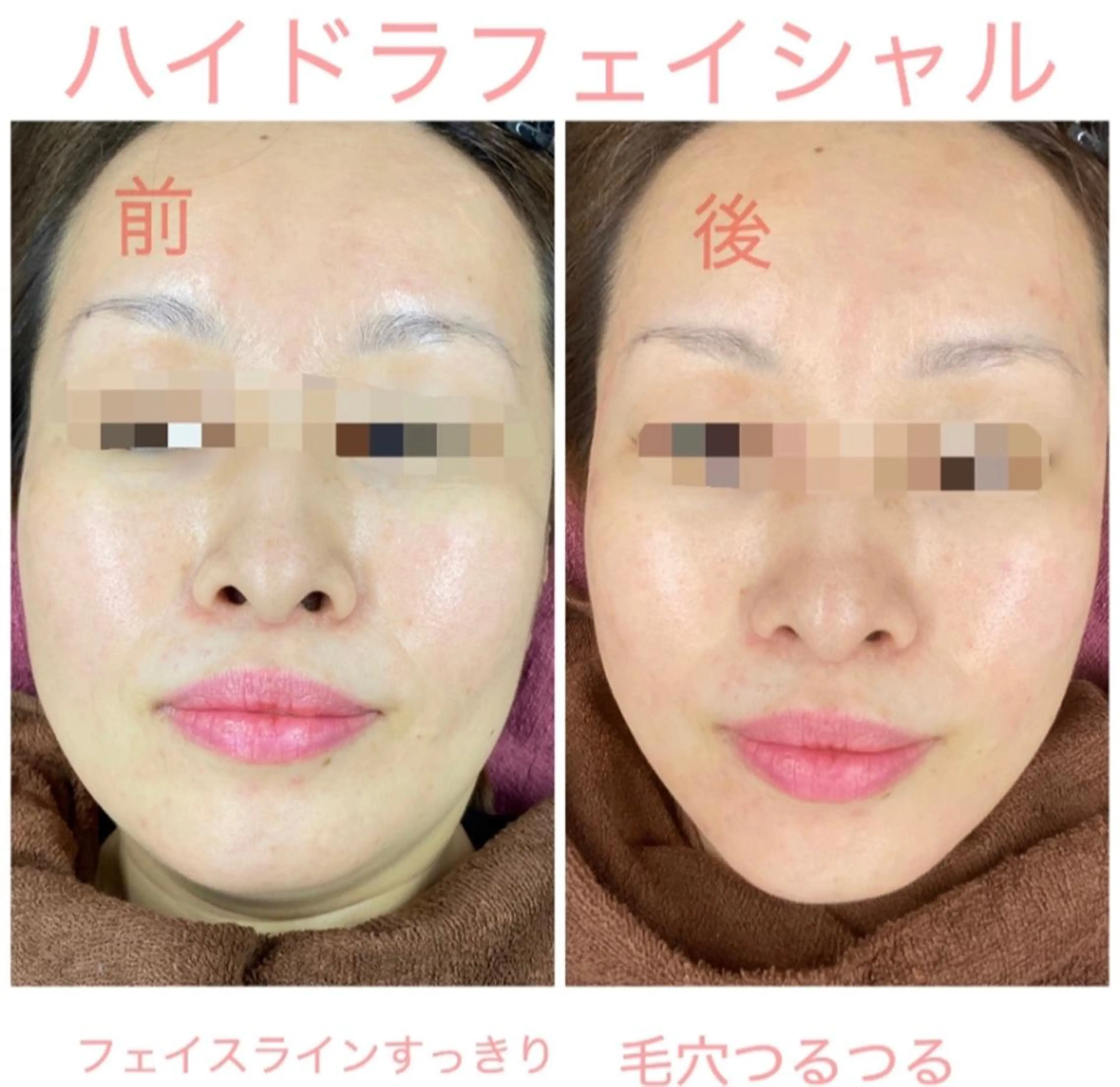 プリート毛穴洗浄美肌 Pulitoのエステ・リラクイメージ