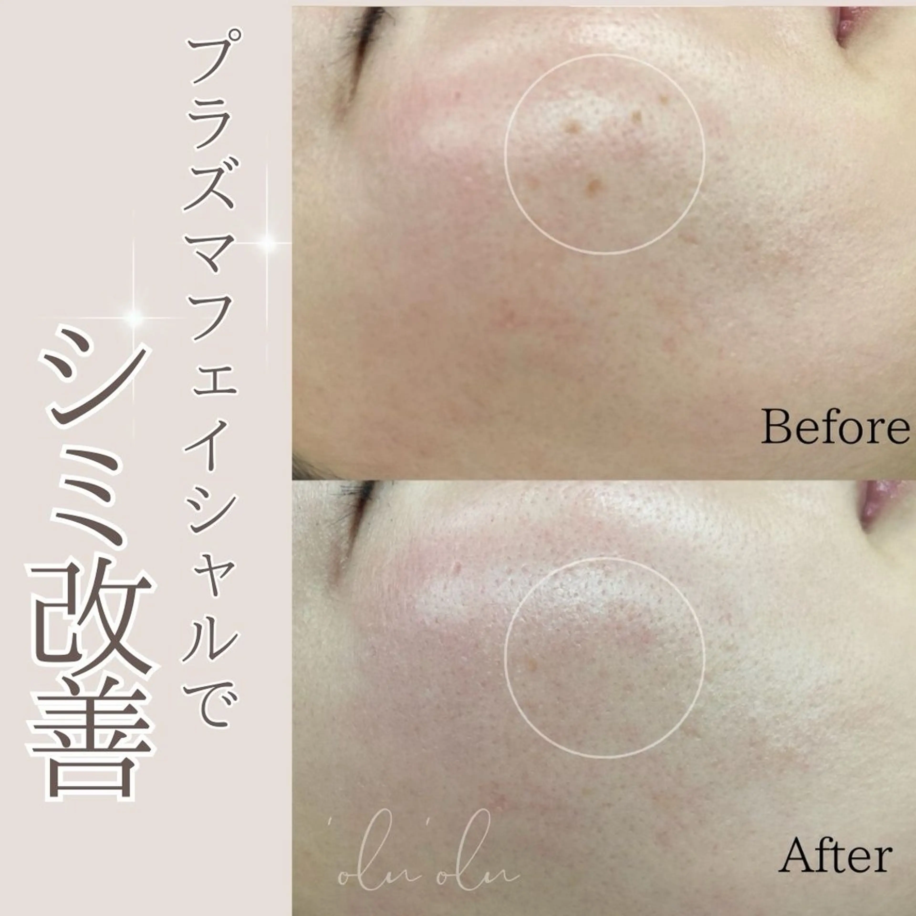 〈医療提携/毛穴・シミケア専門店〉 'Olu'Olu【オルオル】所属・'Olu'Olu シミ・毛穴専門サロンのエステ・リラクイメージ