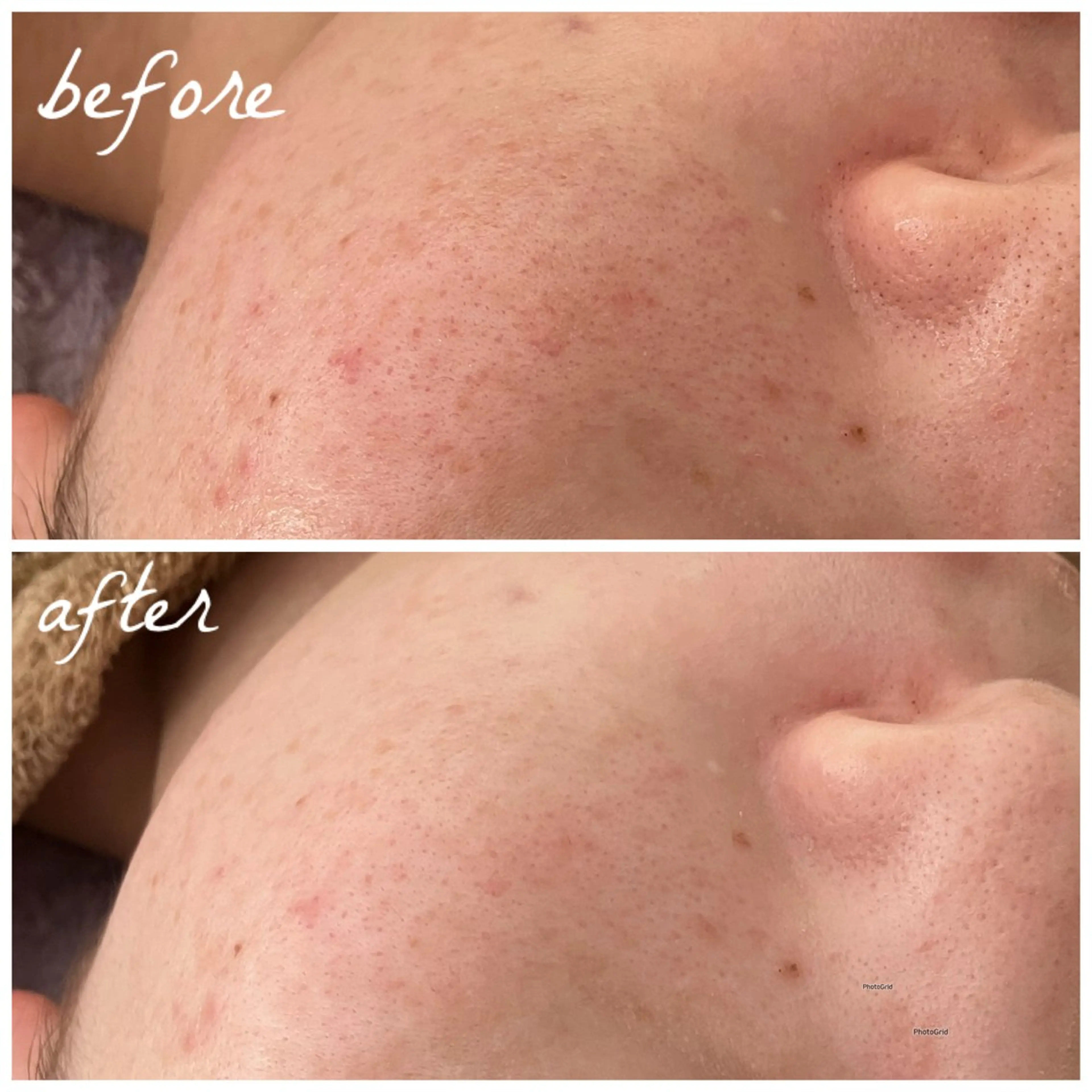 メンズ エステ メナード岐阜茜部 杉浦のエステ・リラクイメージ