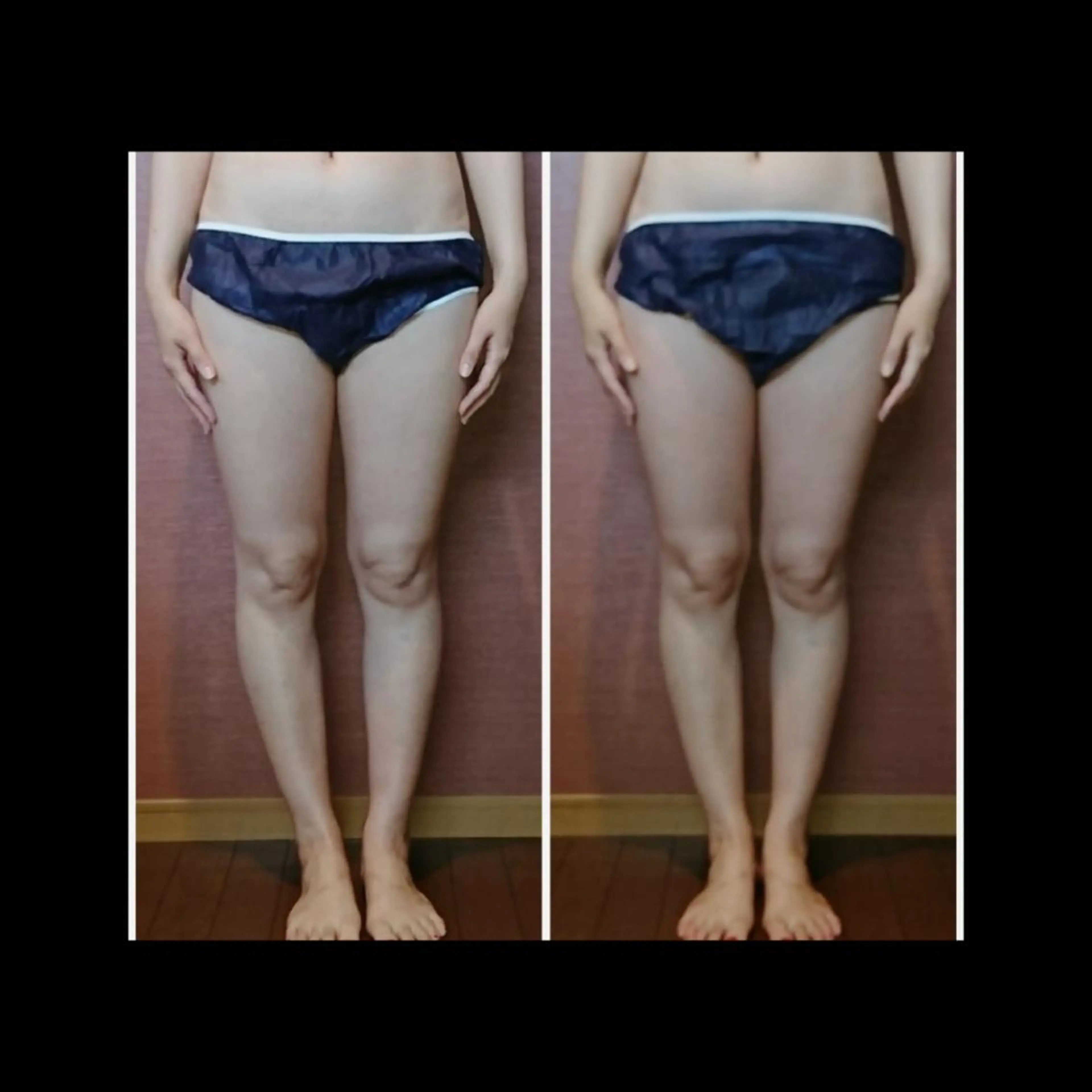 エステ リラク Nako ナコのエステ・リラクイメージ