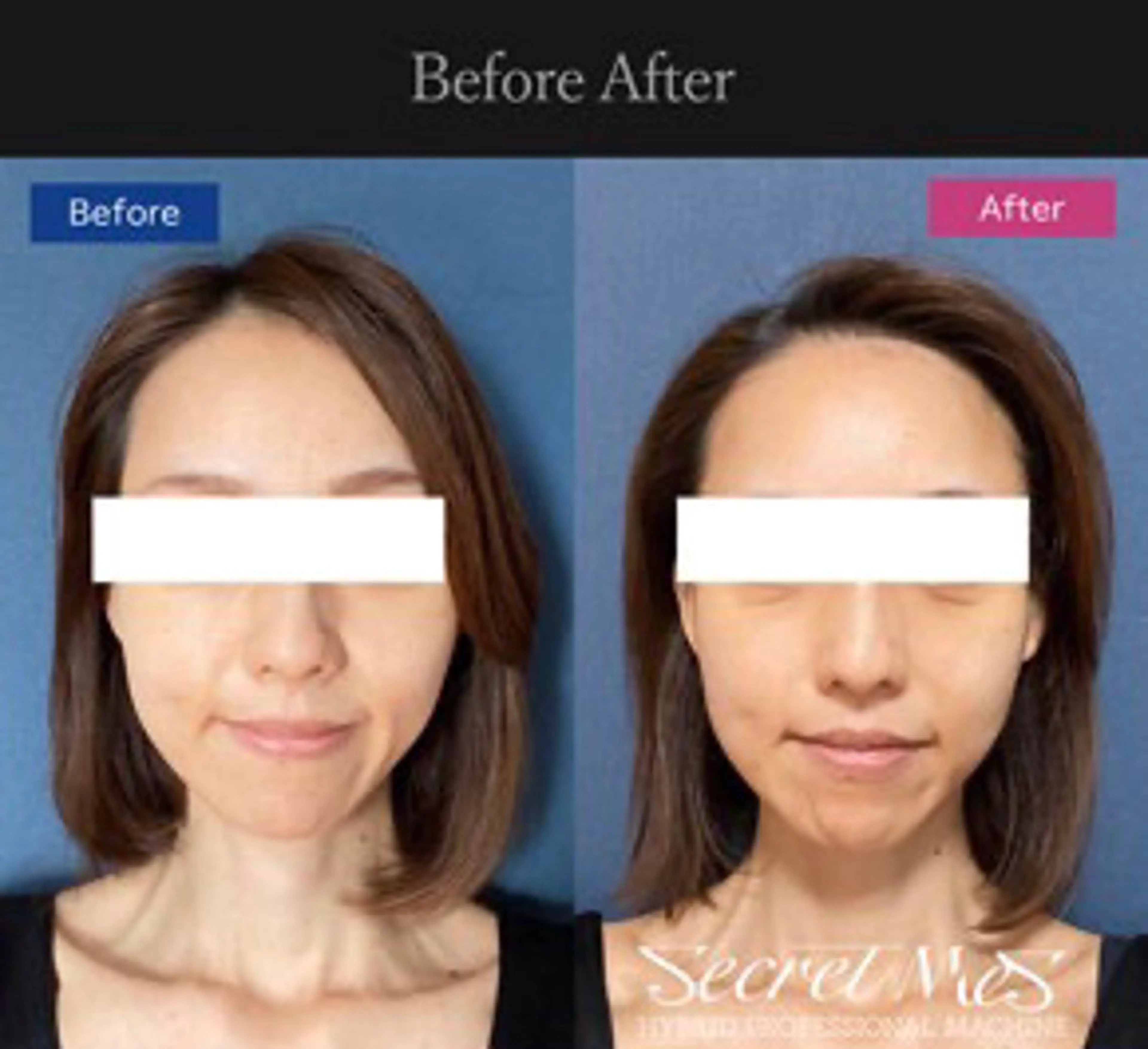 エステ 伊藤 正美のマツエク・マツパデザイン