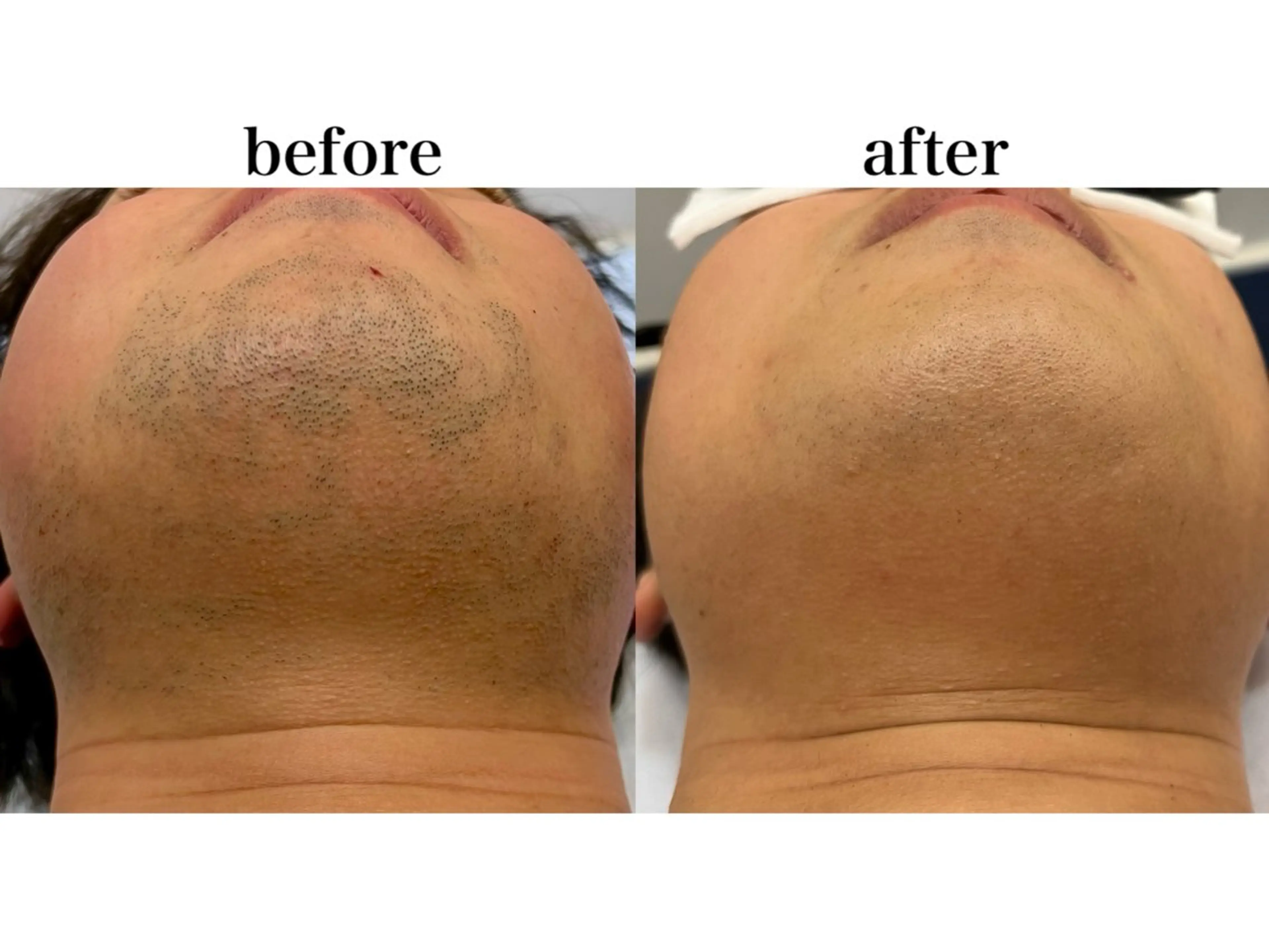 メンズ 脱毛 瀬戸 梨子のエステ・リラクイメージ