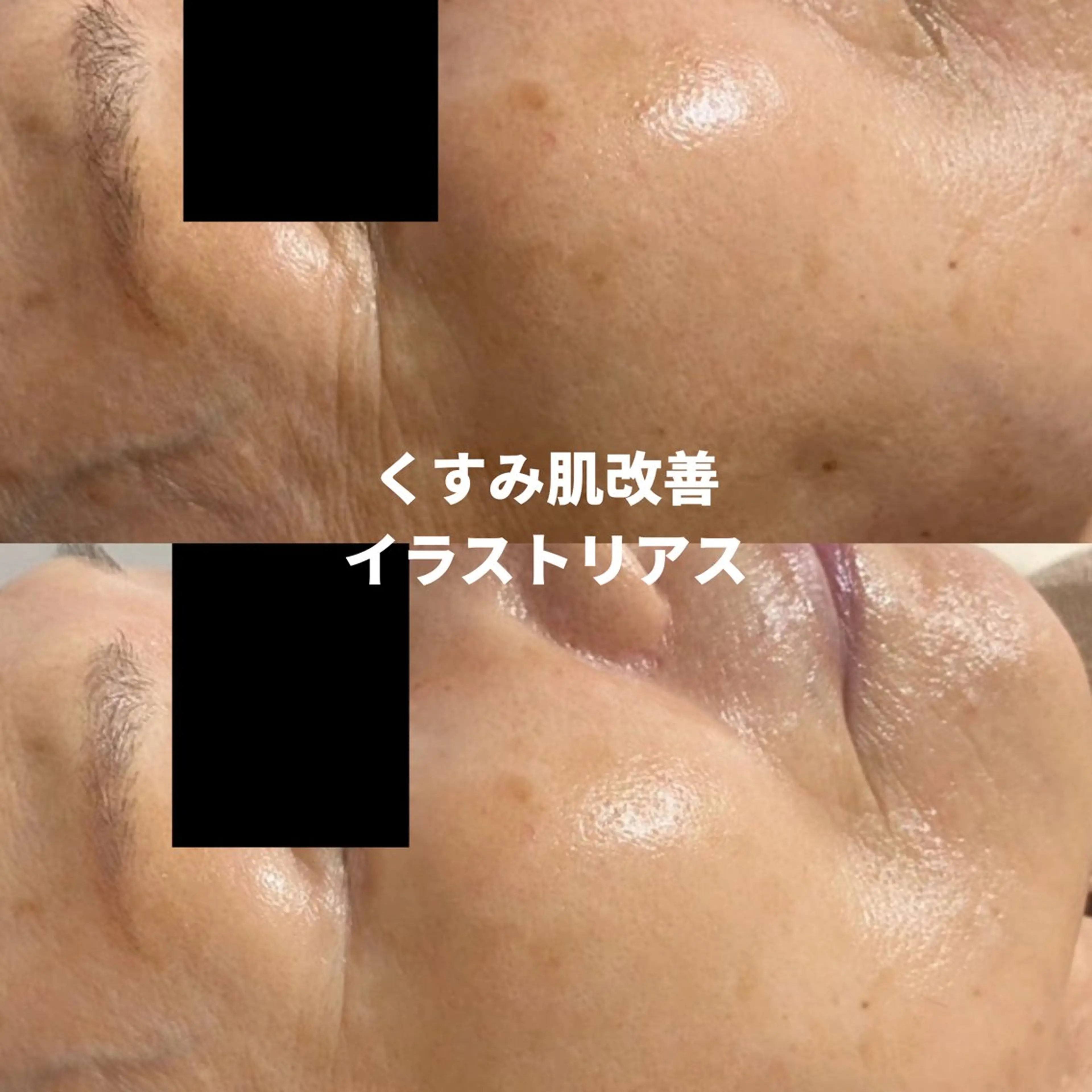 LEPUS【レプス】 sekiのエステ・リラクイメージ