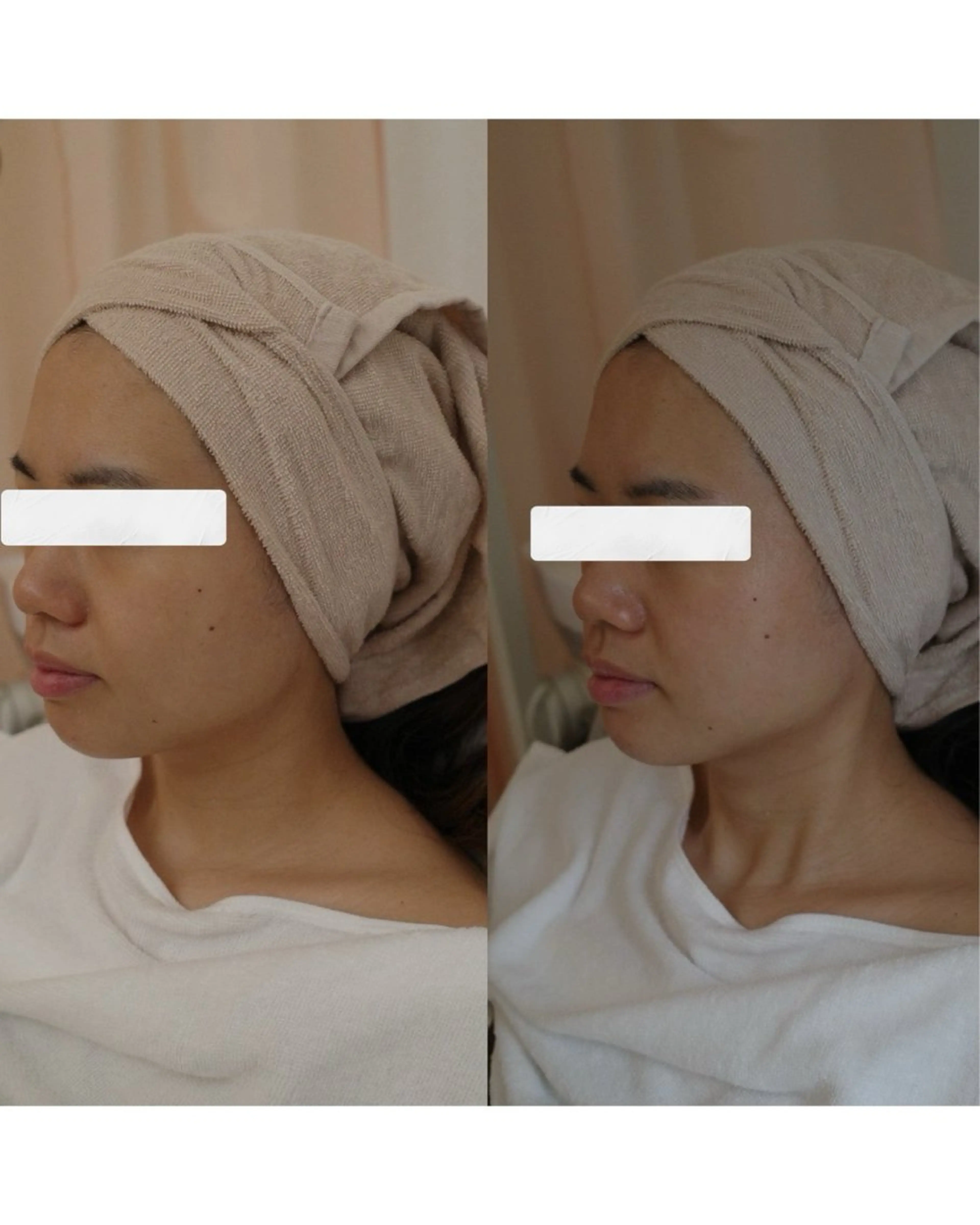 美肌専門サロンcute所属・美肌専門サロン cuteのエステ・リラクイメージ