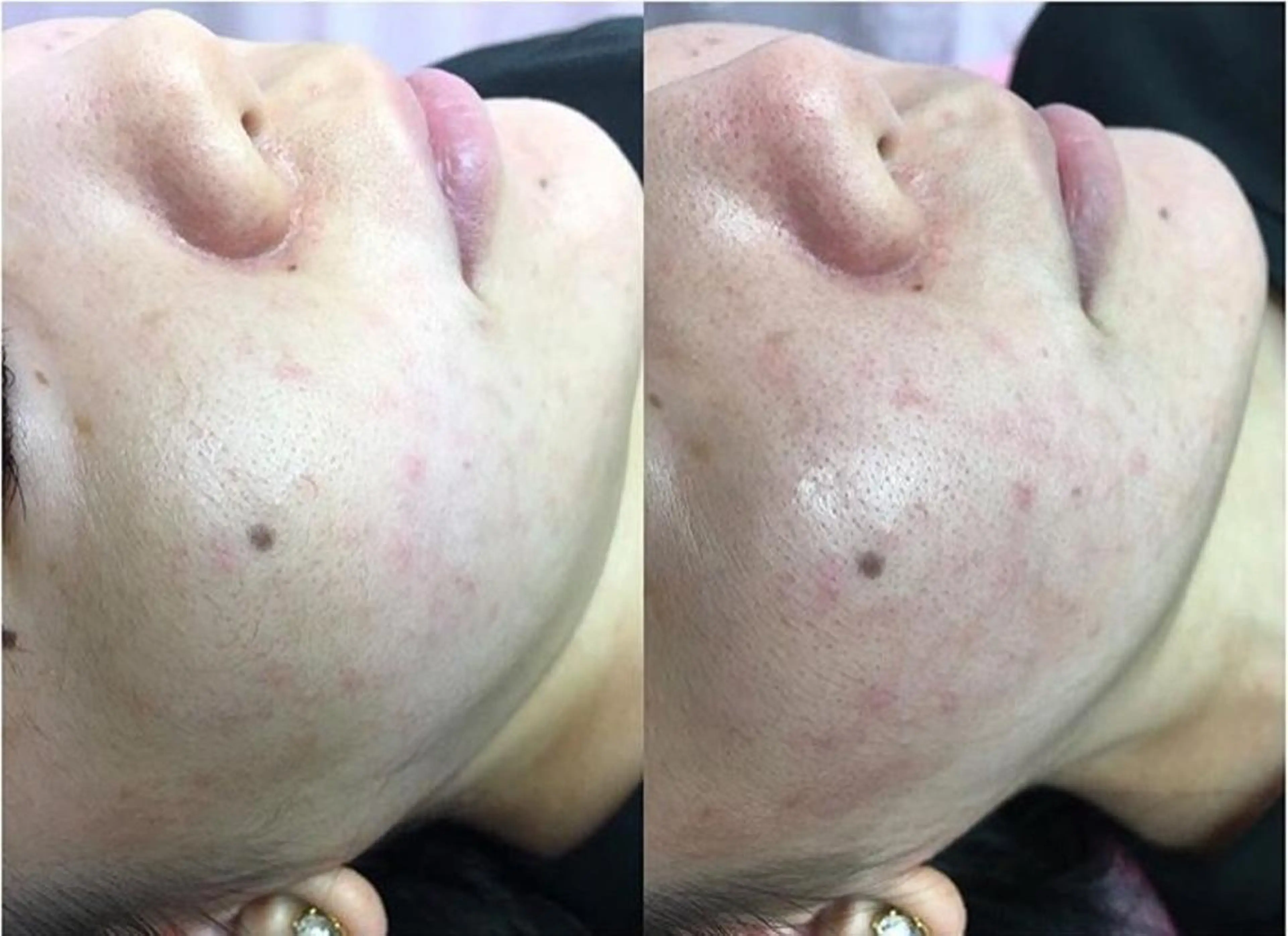 Fes Bonito❤所属・kawano shieriのエステ・リラクイメージ