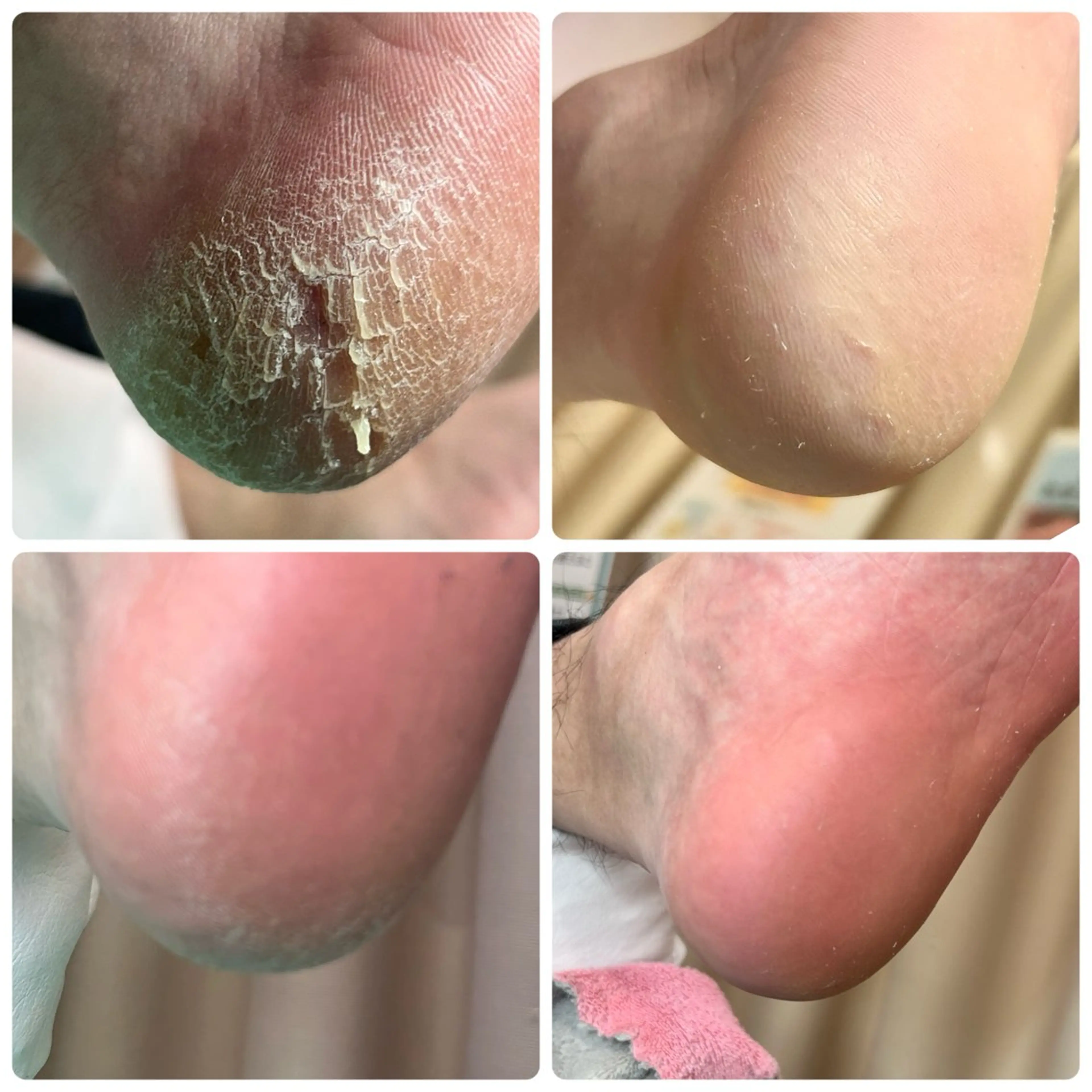 その他 巻き爪補正店　柏店所属・巻き爪補正店 柏店のその他イメージ